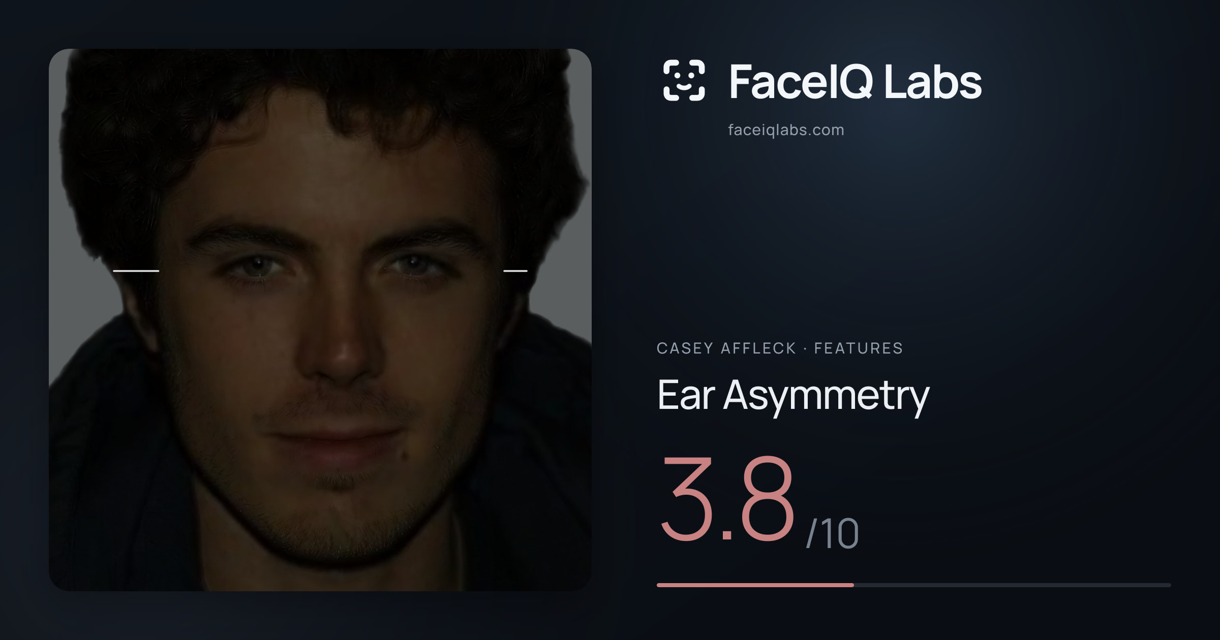 Casey Affleck Ear Asymmetry: 3.8/10, drawn on the photo