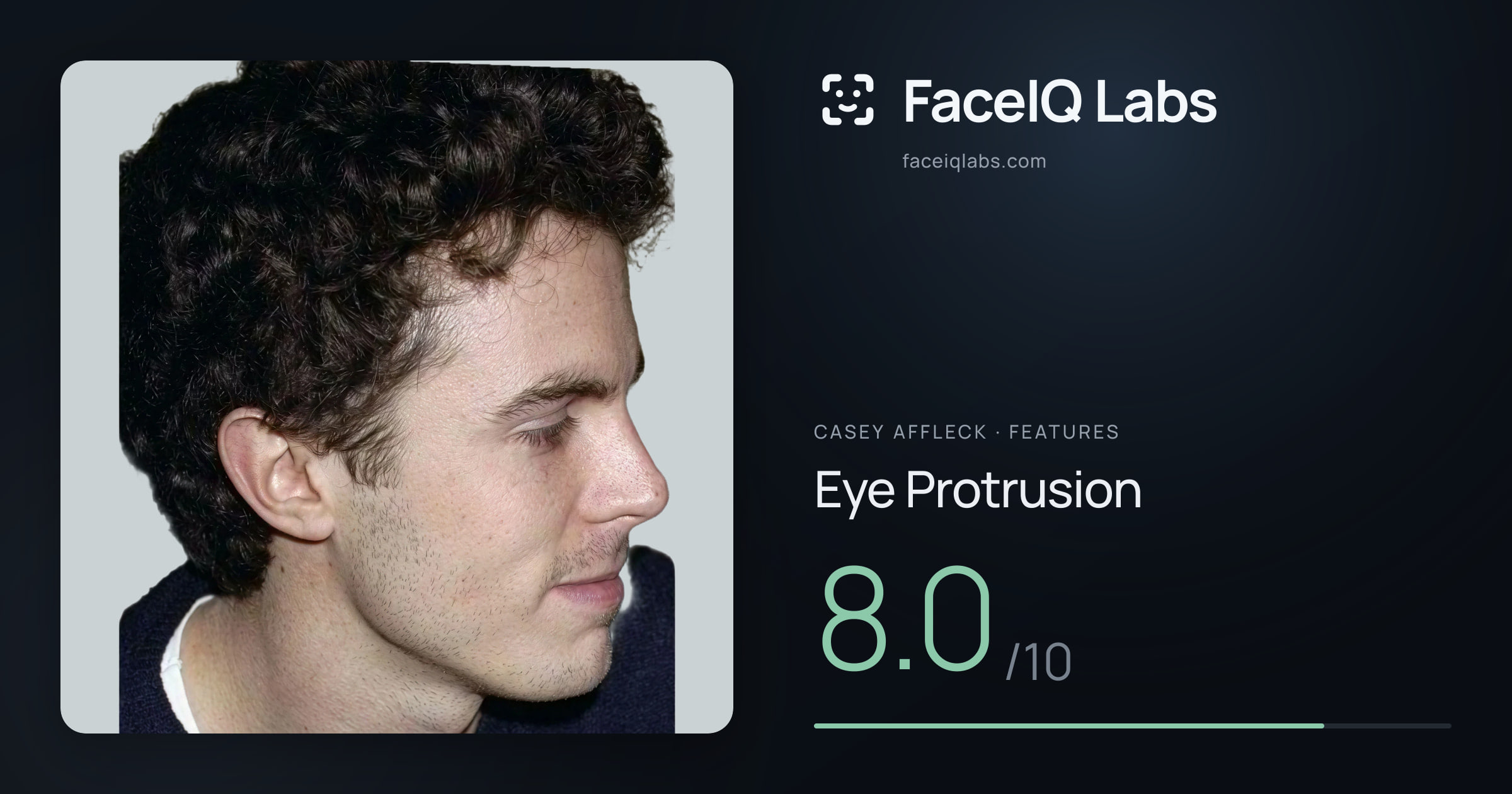 Casey Affleck Eye Protrusion: 8.0/10, drawn on the photo