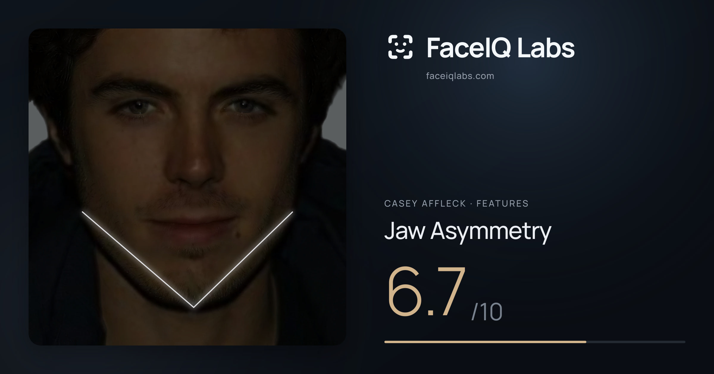 Casey Affleck Jaw Asymmetry: 6.7/10, drawn on the photo