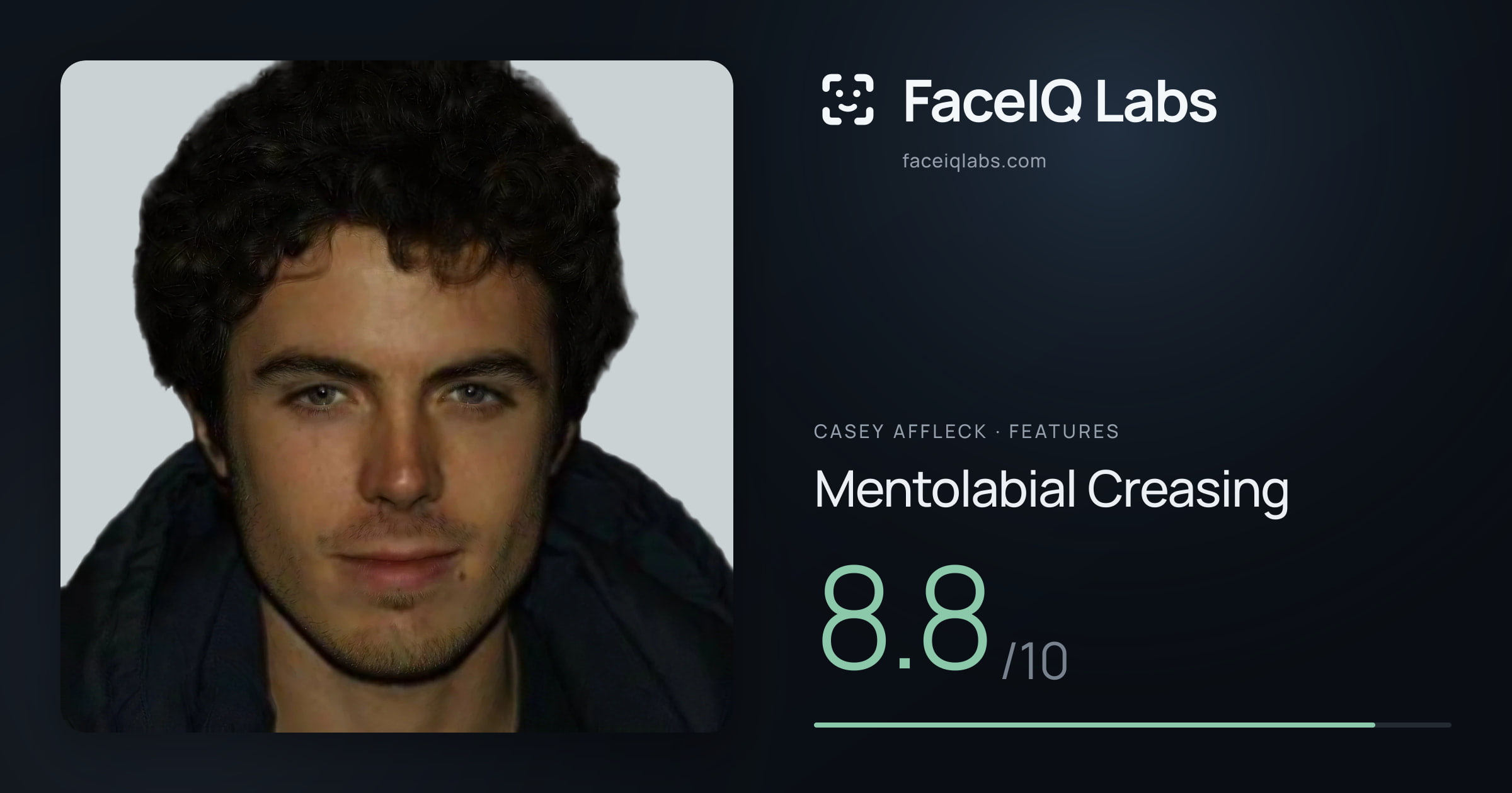 Casey Affleck Mentolabial Creasing: 8.8/10, drawn on the photo