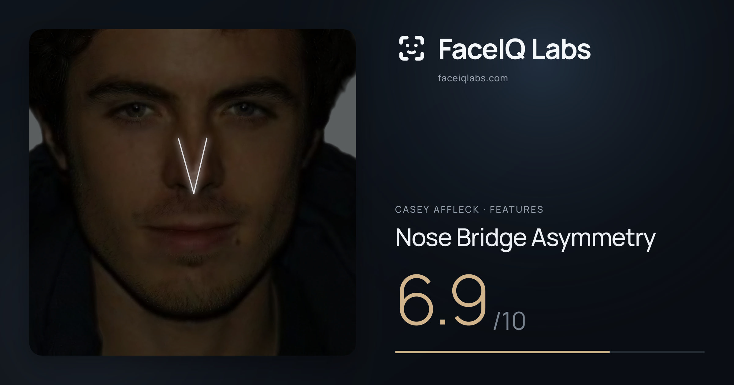 Casey Affleck Nose Bridge Asymmetry: 6.9/10, drawn on the photo