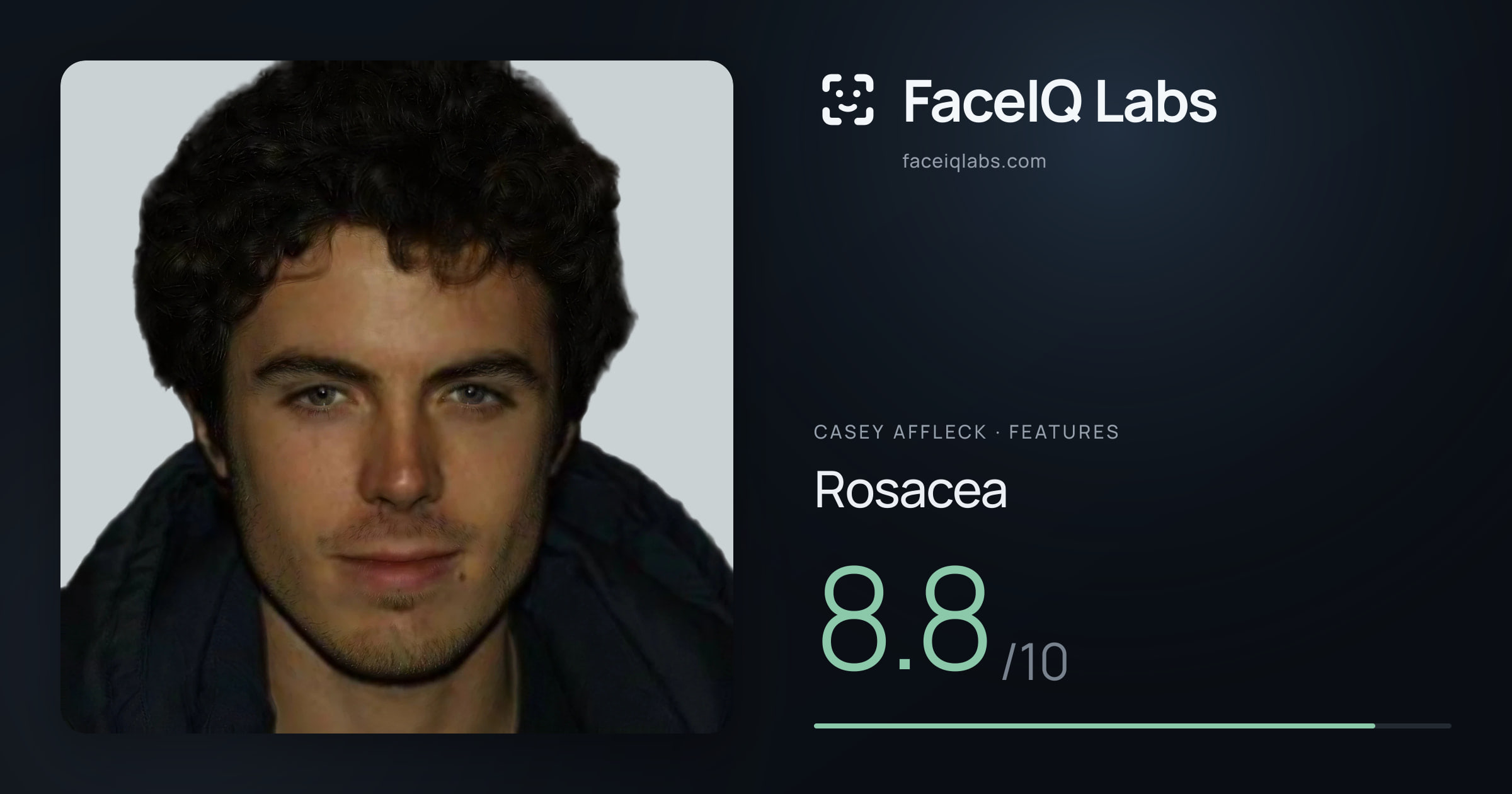 Casey Affleck Rosacea: 8.8/10, drawn on the photo