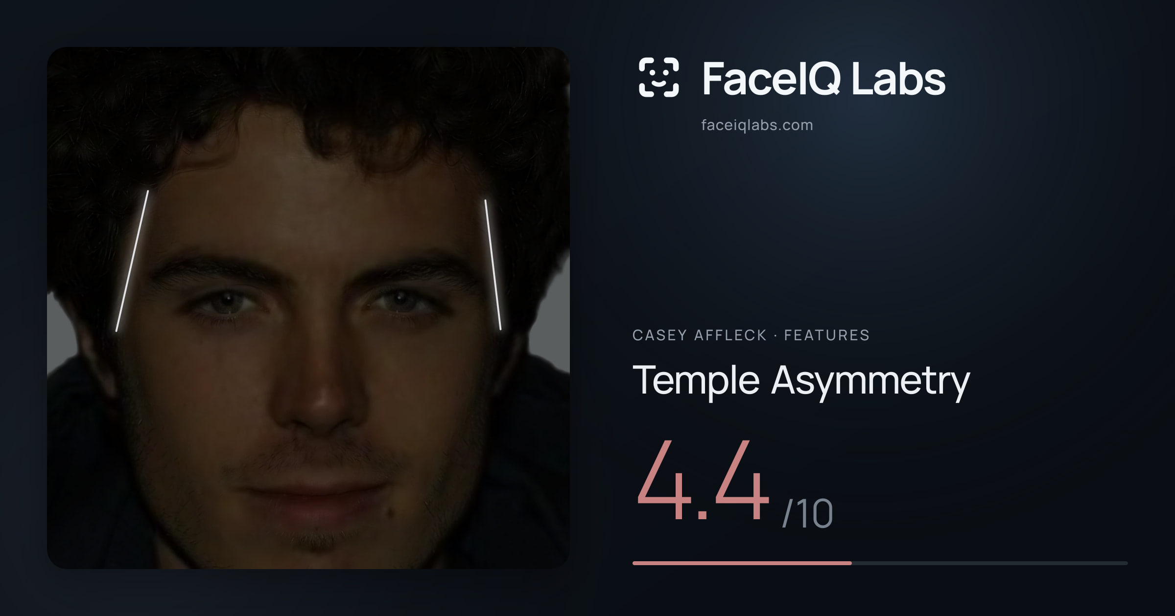 Casey Affleck Temple Asymmetry: 4.4/10, drawn on the photo