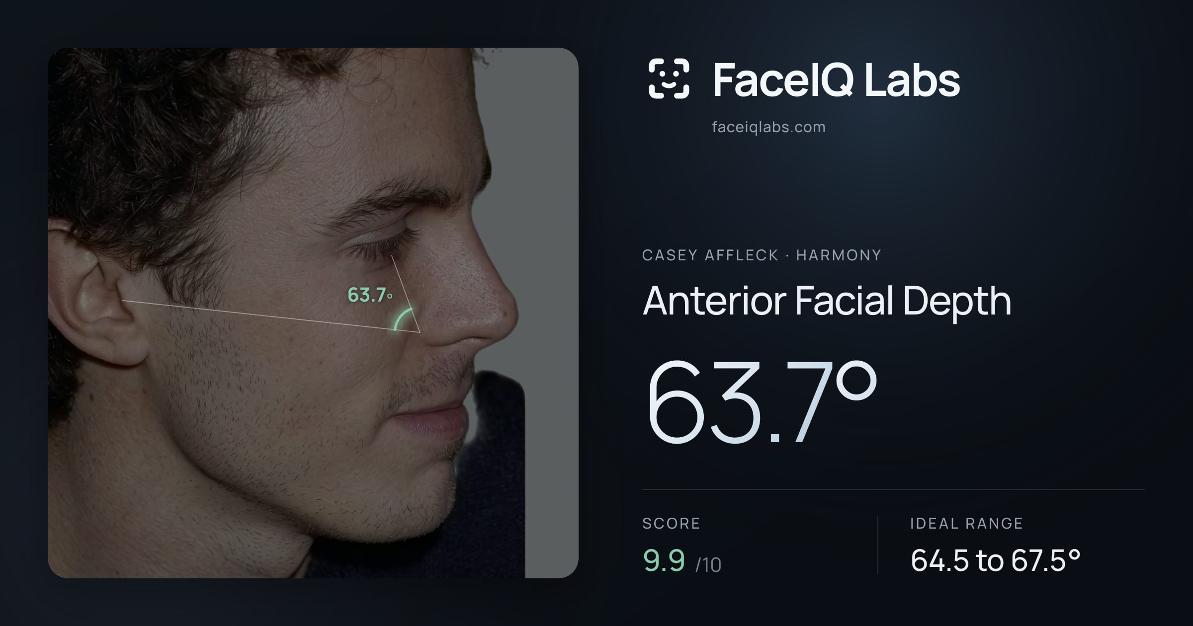 Casey Affleck Anterior Facial Depth: 63.7°, drawn on the photo