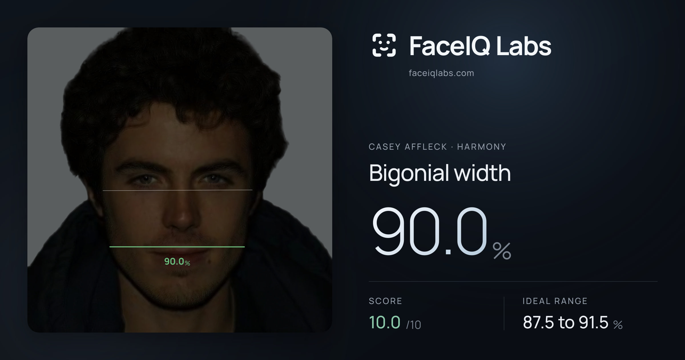 Casey Affleck Bigonial width: 90.0%, drawn on the photo