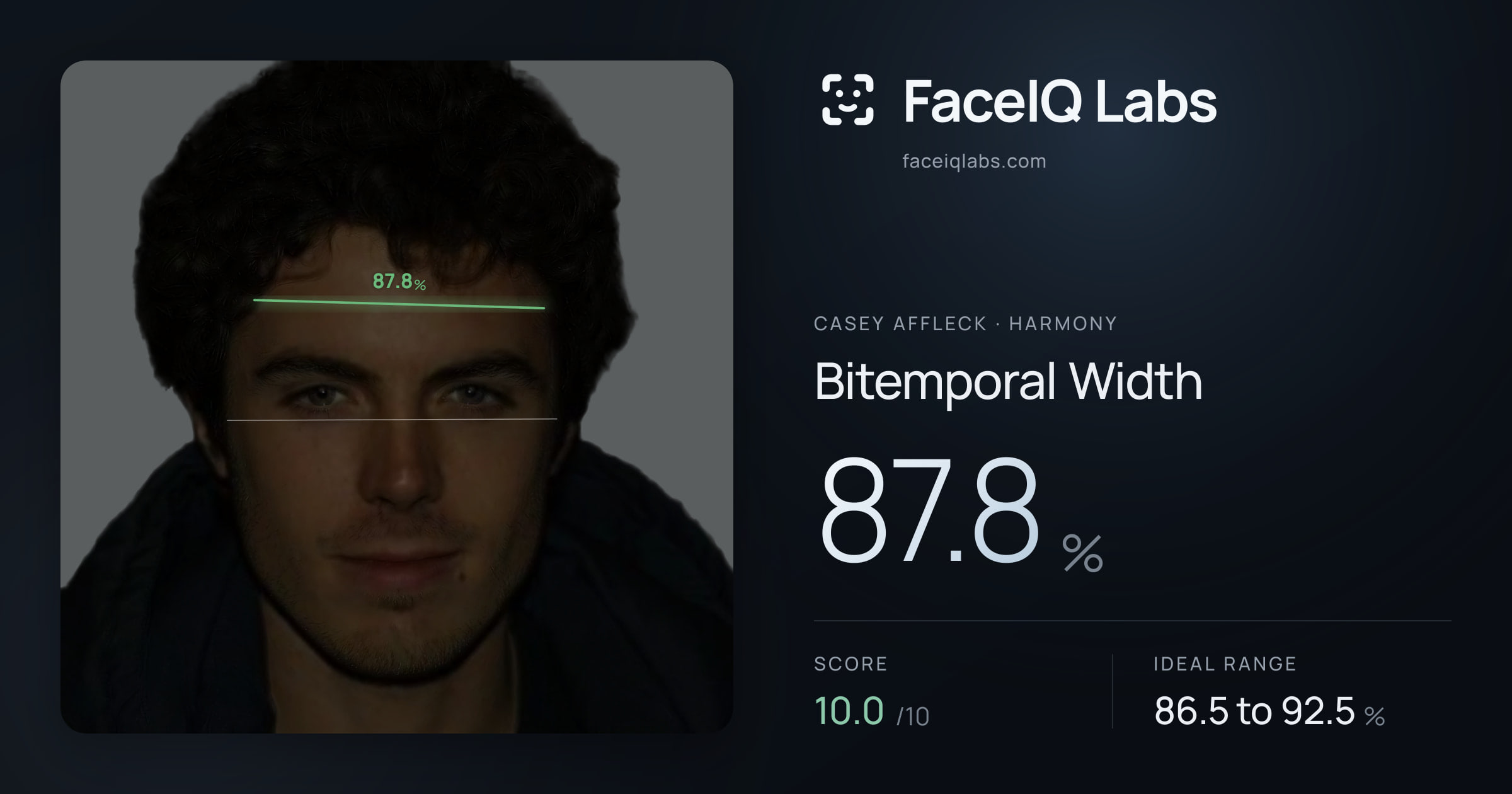 Casey Affleck Bitemporal Width: 87.8%, drawn on the photo