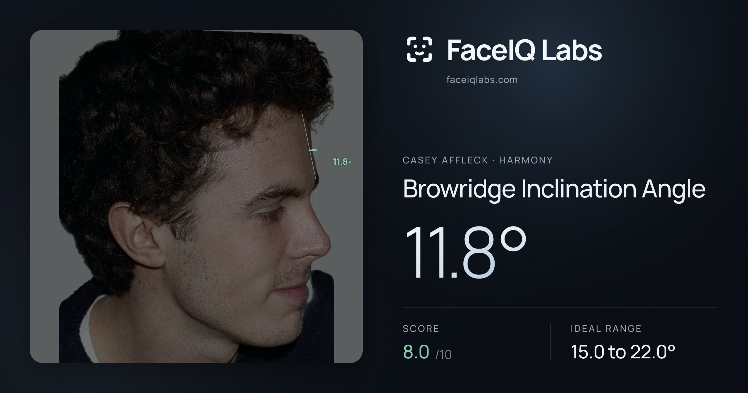 Casey Affleck Browridge Inclination Angle: 11.8°, drawn on the photo