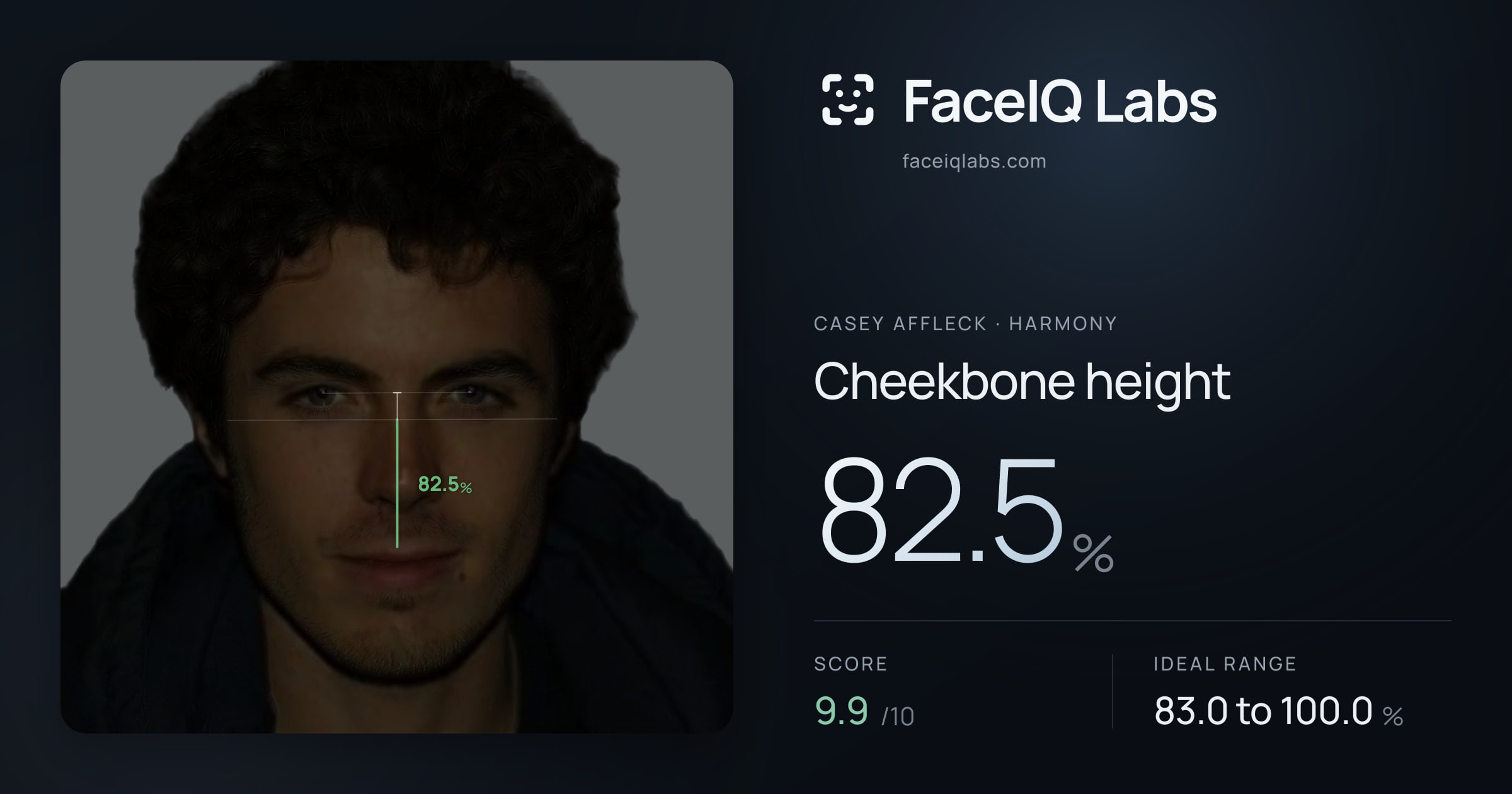 Casey Affleck Cheekbone height: 82.5%, drawn on the photo