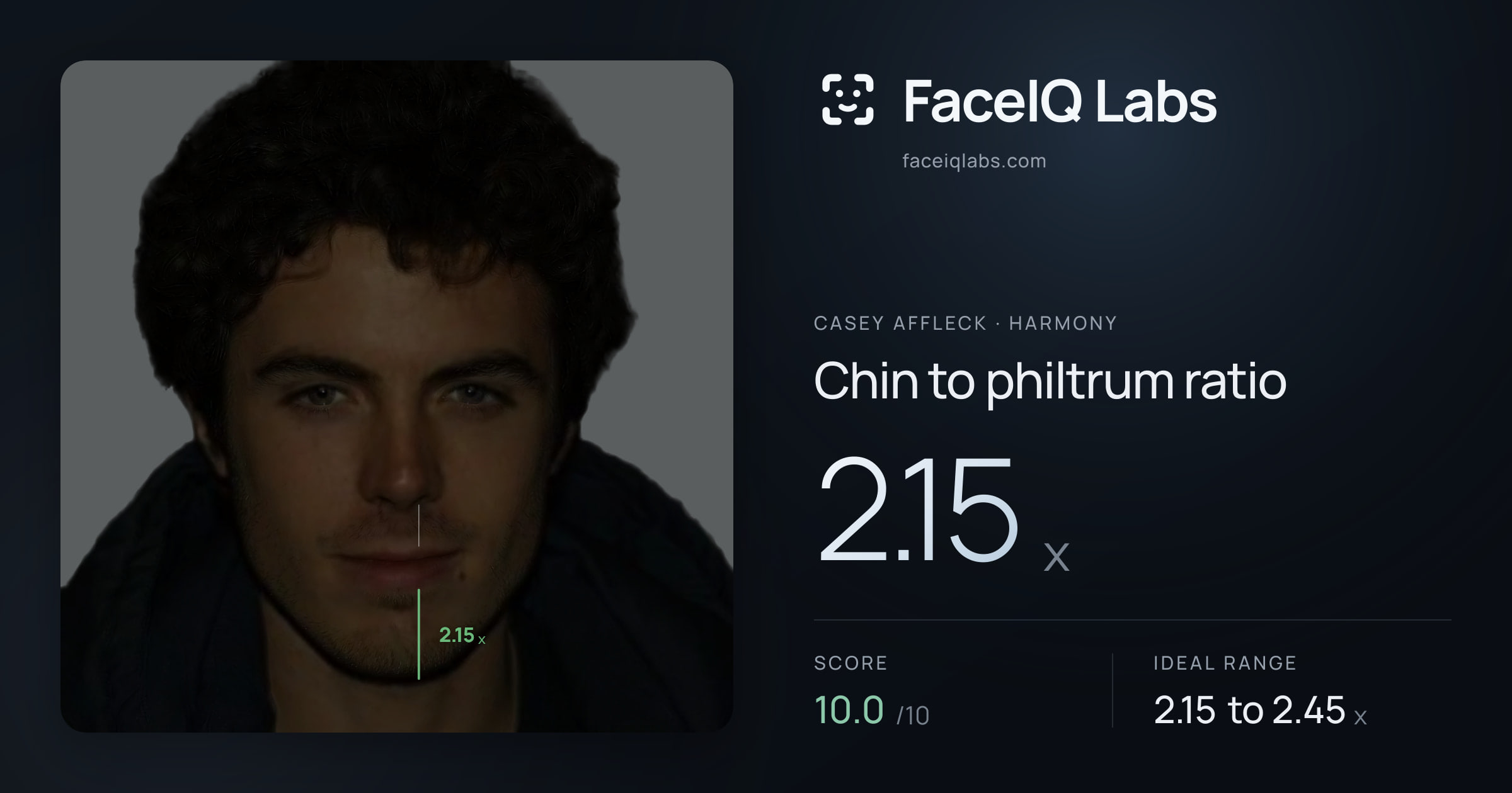 Casey Affleck Chin to philtrum ratio: 2.15x, drawn on the photo