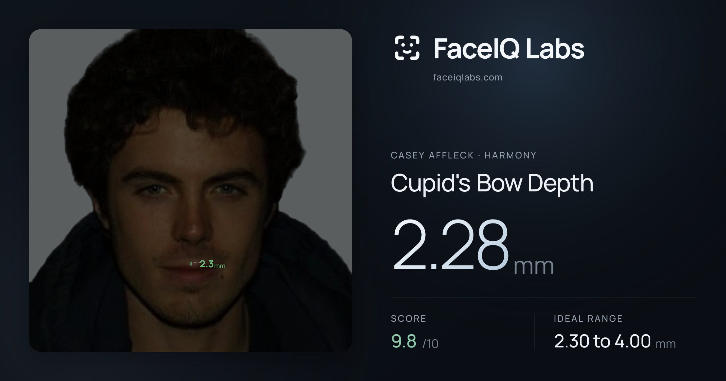 Casey Affleck Cupid's Bow Depth: 2.28mm, drawn on the photo