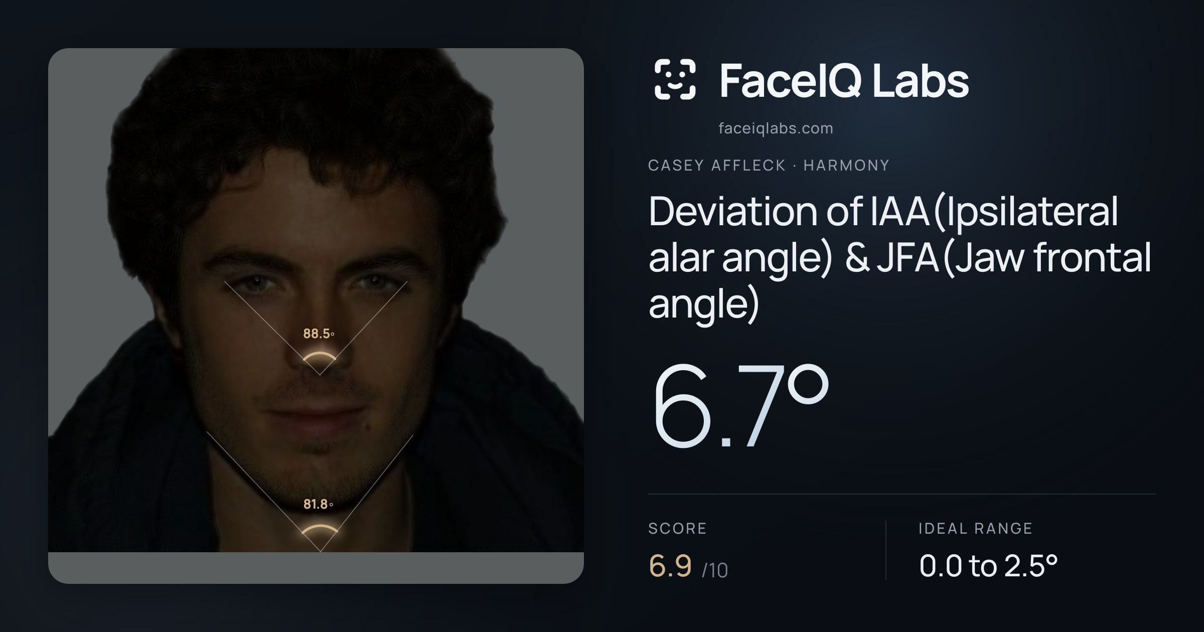 Casey Affleck Deviation of IAA(Ipsilateral alar angle) & JFA(Jaw frontal angle): 6.7°, drawn on the photo