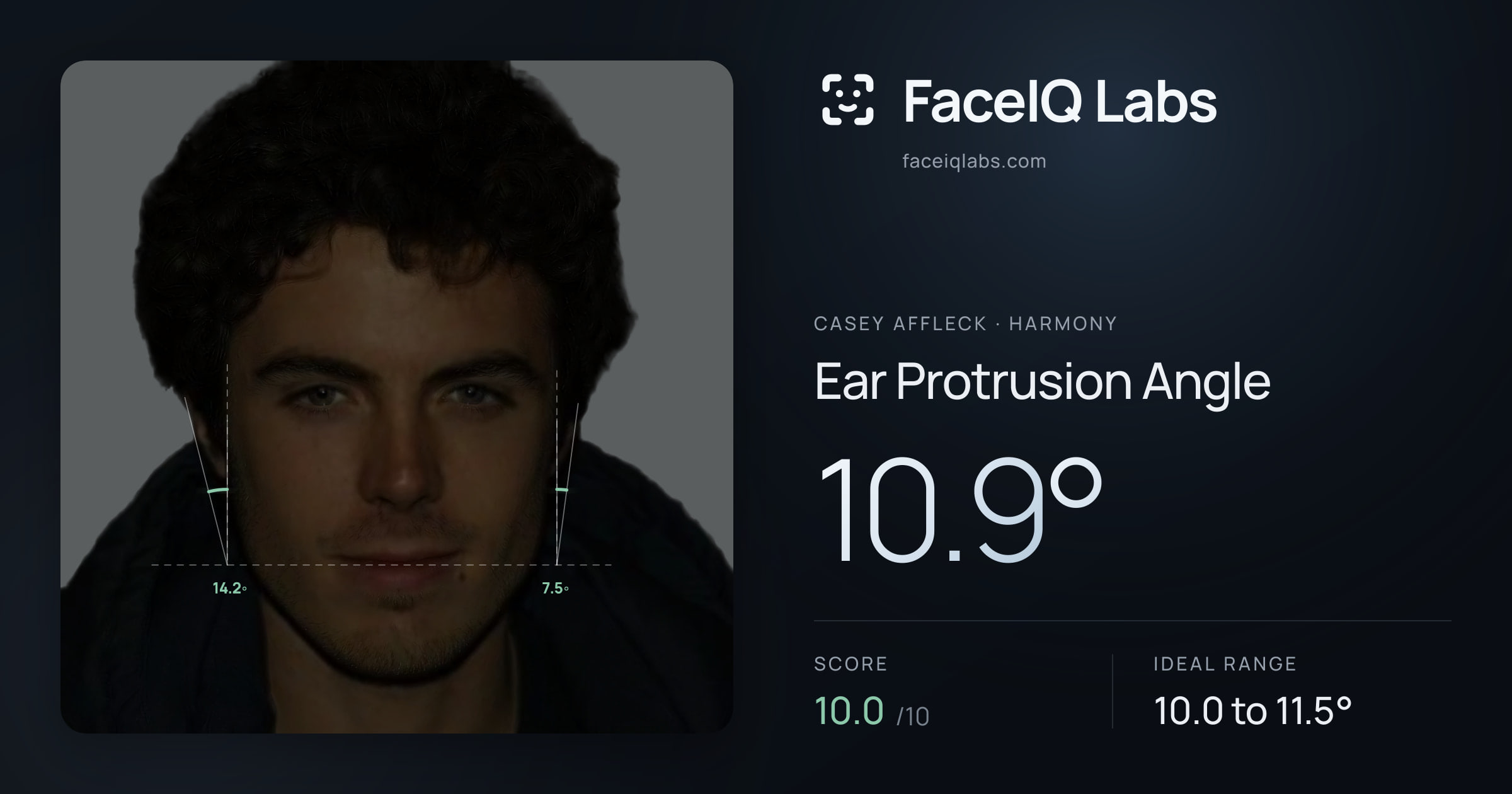 Casey Affleck Ear Protrusion Angle: 10.9°, drawn on the photo