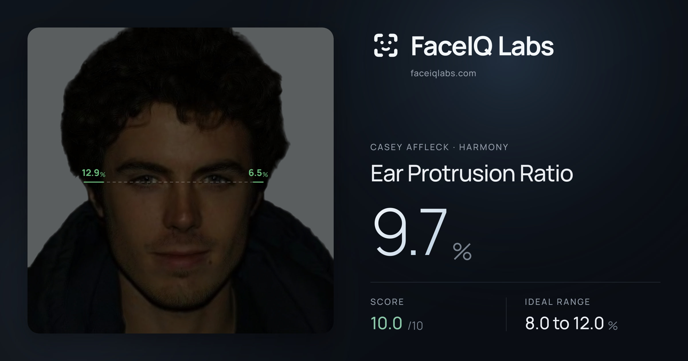Casey Affleck Ear Protrusion Ratio: 9.7%, drawn on the photo