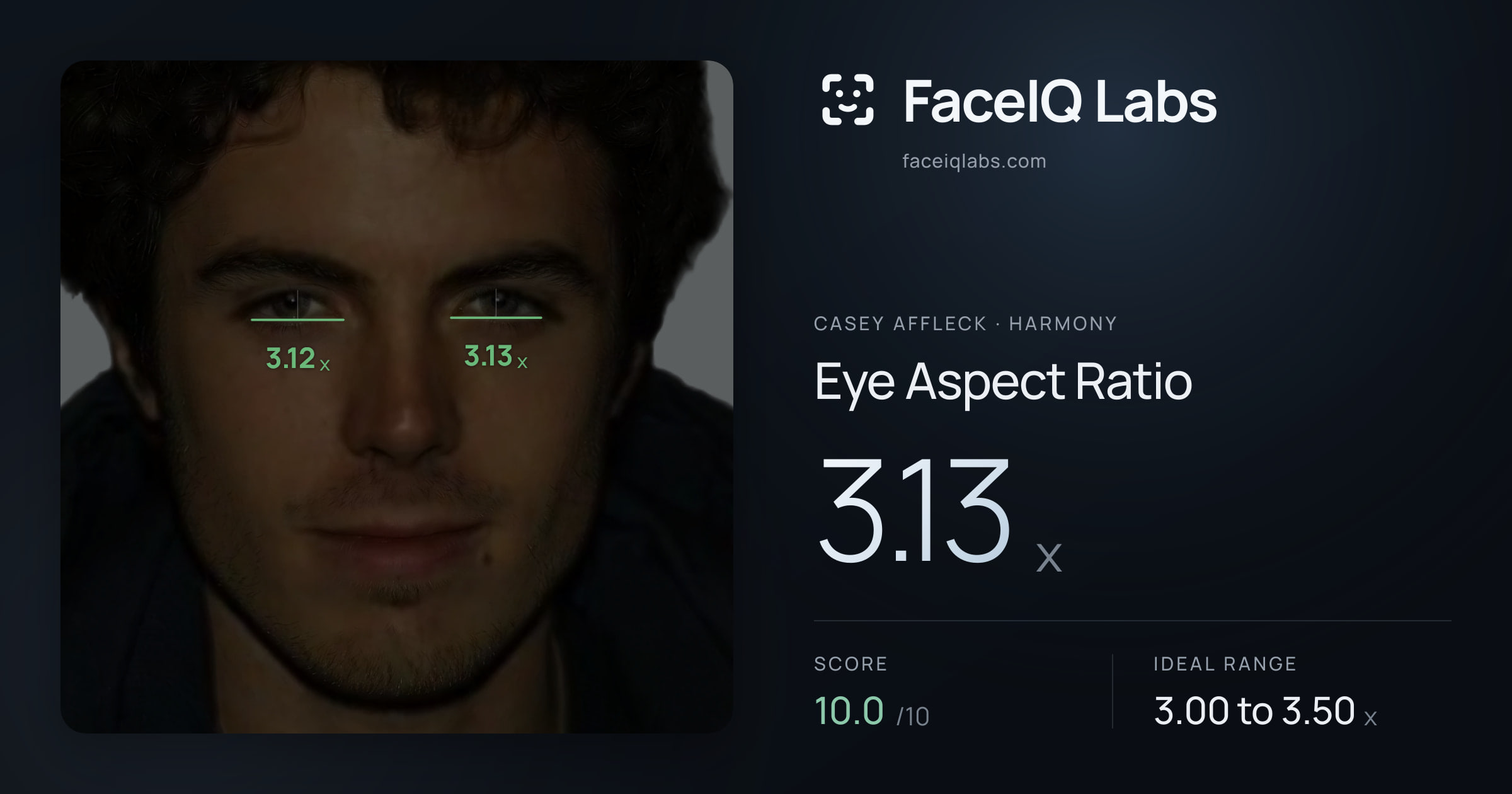Casey Affleck Eye Aspect Ratio: 3.13x, drawn on the photo