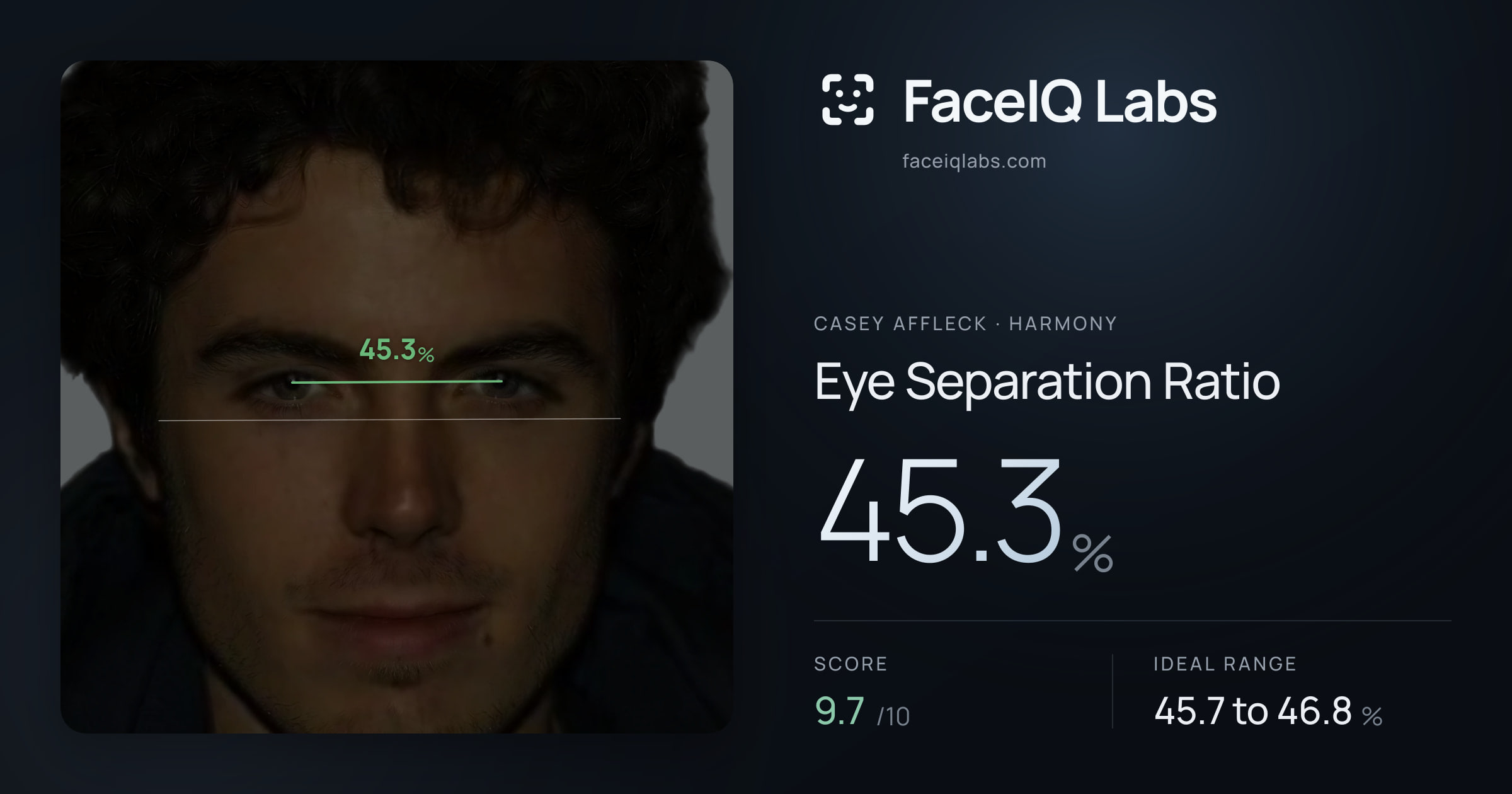 Casey Affleck Eye Separation Ratio: 45.3%, drawn on the photo