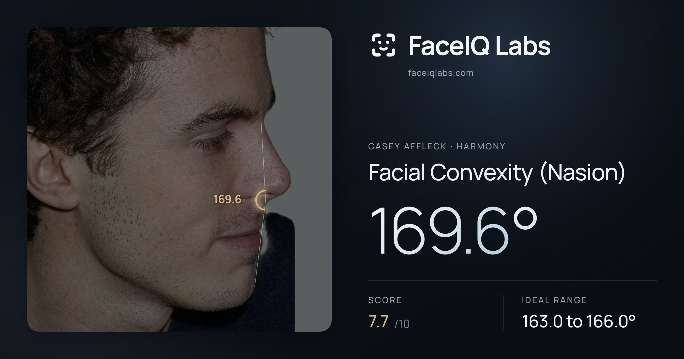 Casey Affleck Facial Convexity (Nasion): 169.6°, drawn on the photo