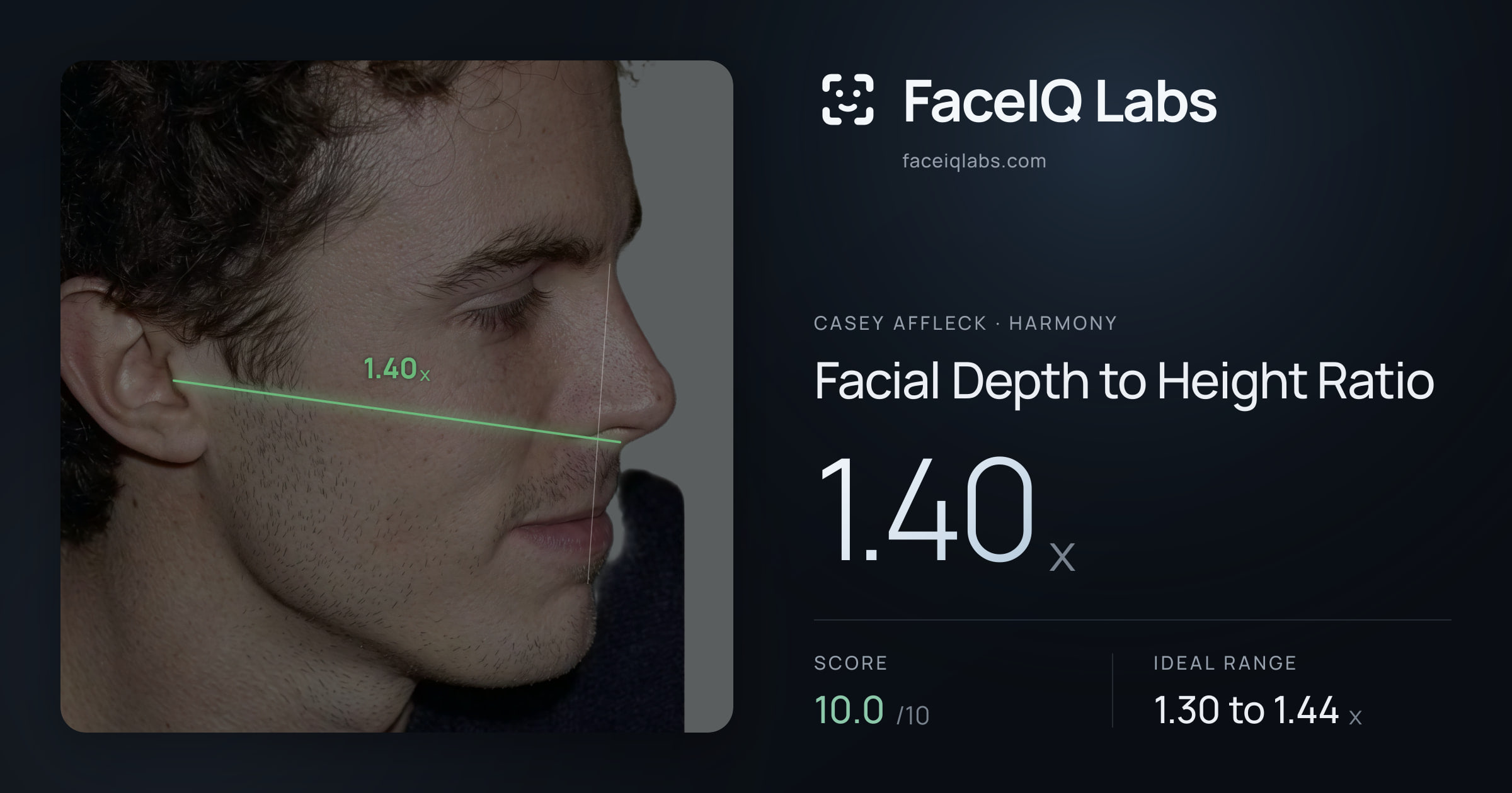 Casey Affleck Facial Depth to Height Ratio: 1.40x, drawn on the photo