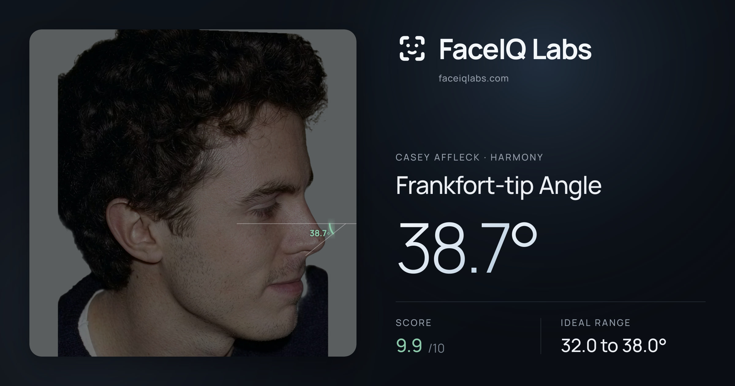 Casey Affleck Frankfort-tip Angle: 38.7°, drawn on the photo