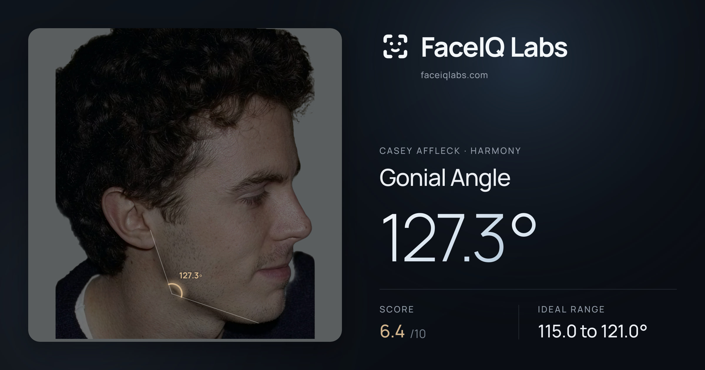 Casey Affleck Gonial Angle: 127.3°, drawn on the photo