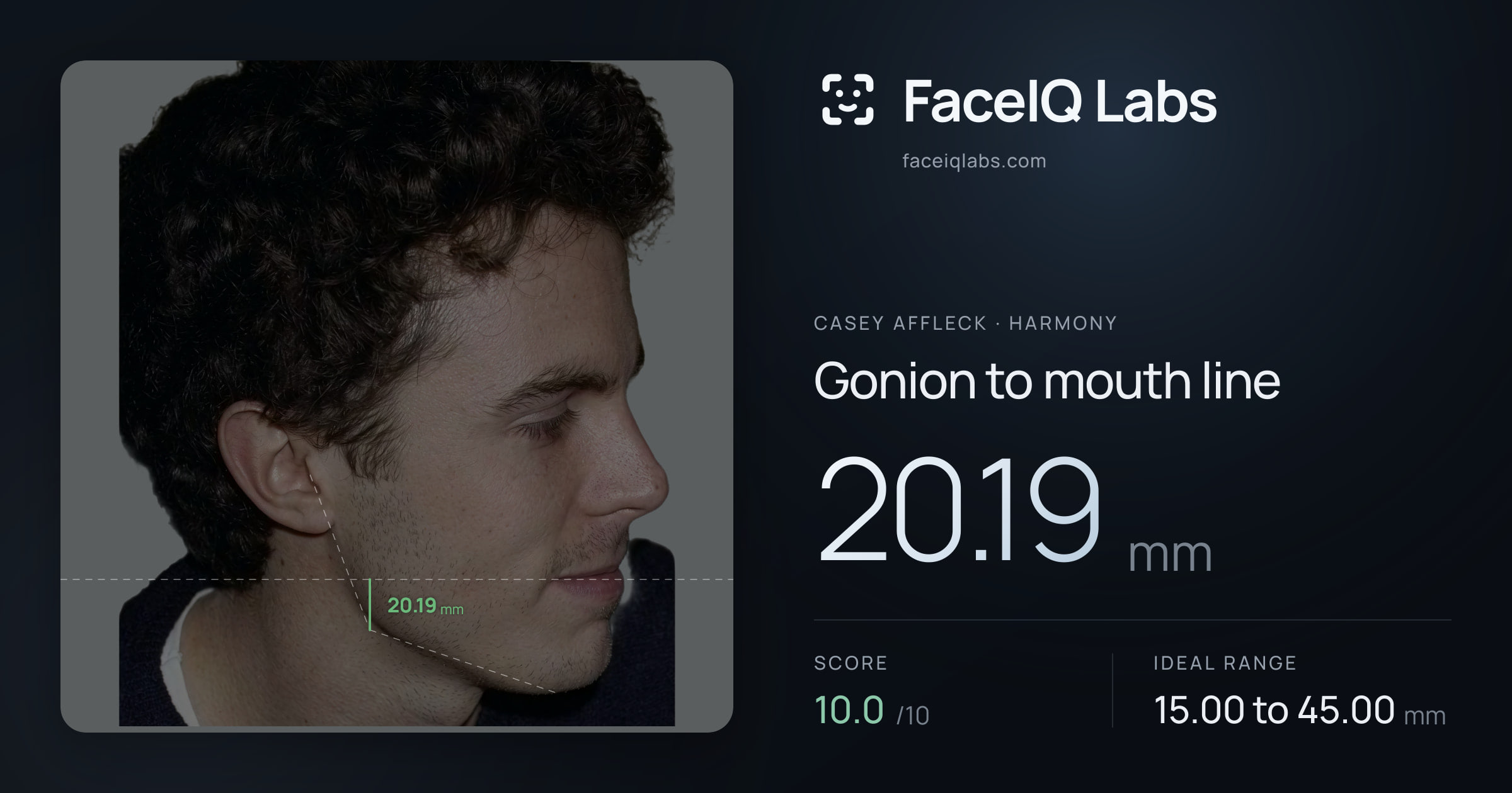 Casey Affleck Gonion to mouth line: 20.19mm, drawn on the photo