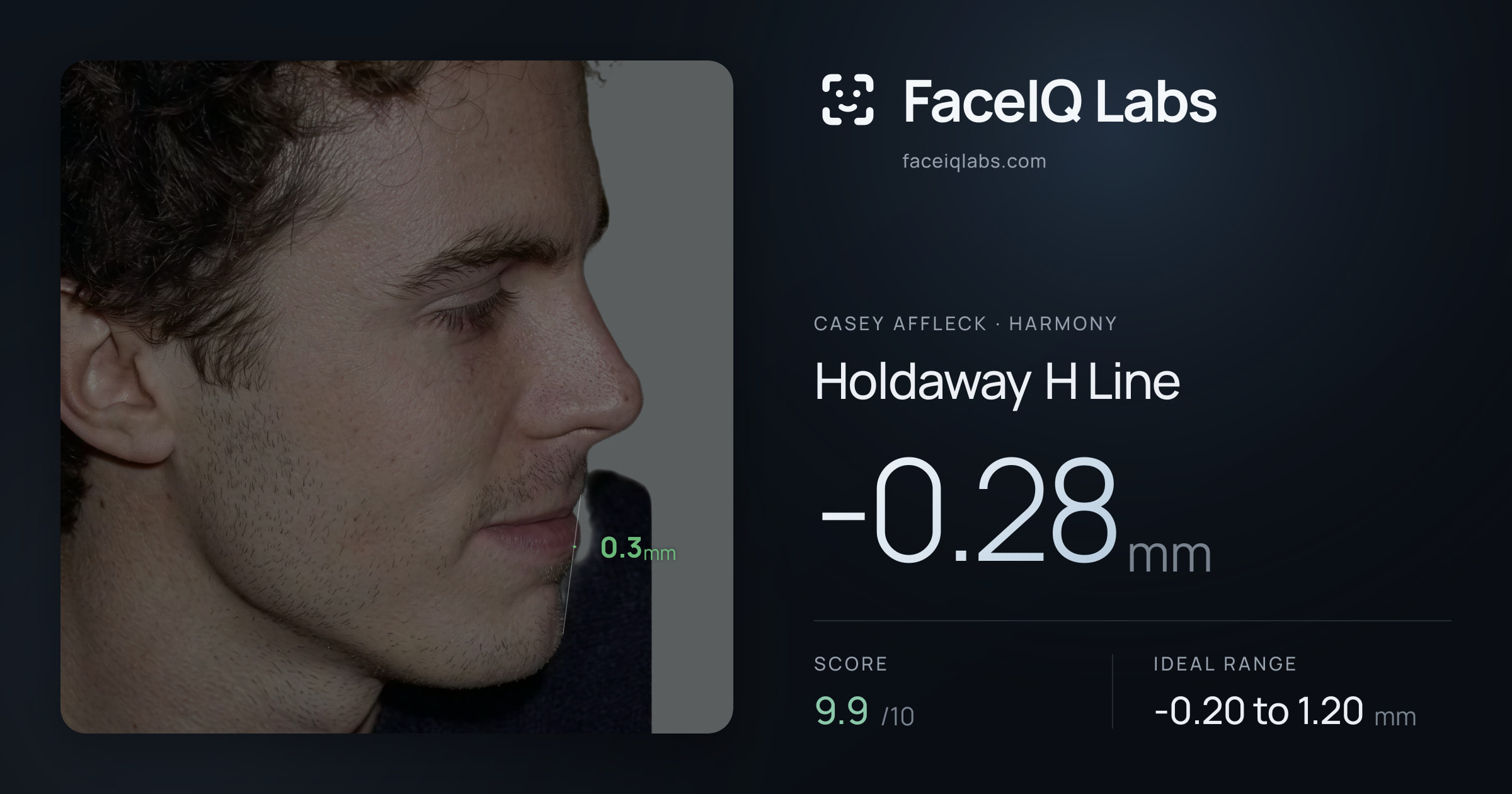 Casey Affleck Holdaway H Line: -0.28mm, drawn on the photo