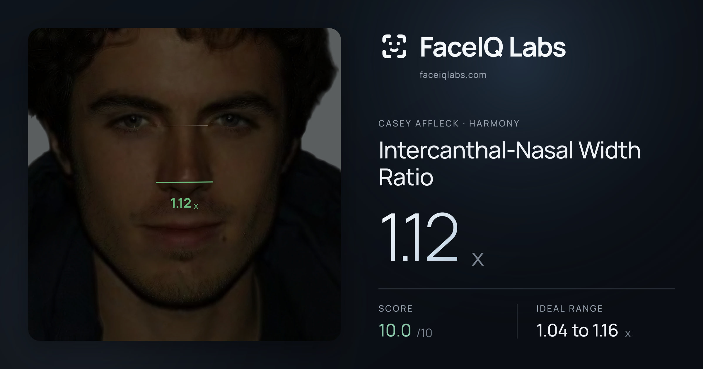Casey Affleck Intercanthal-Nasal Width Ratio: 1.12x, drawn on the photo