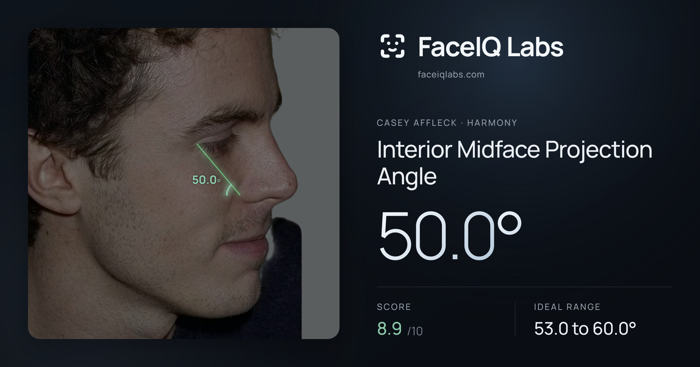 Casey Affleck Interior Midface Projection Angle: 50.0°, drawn on the photo