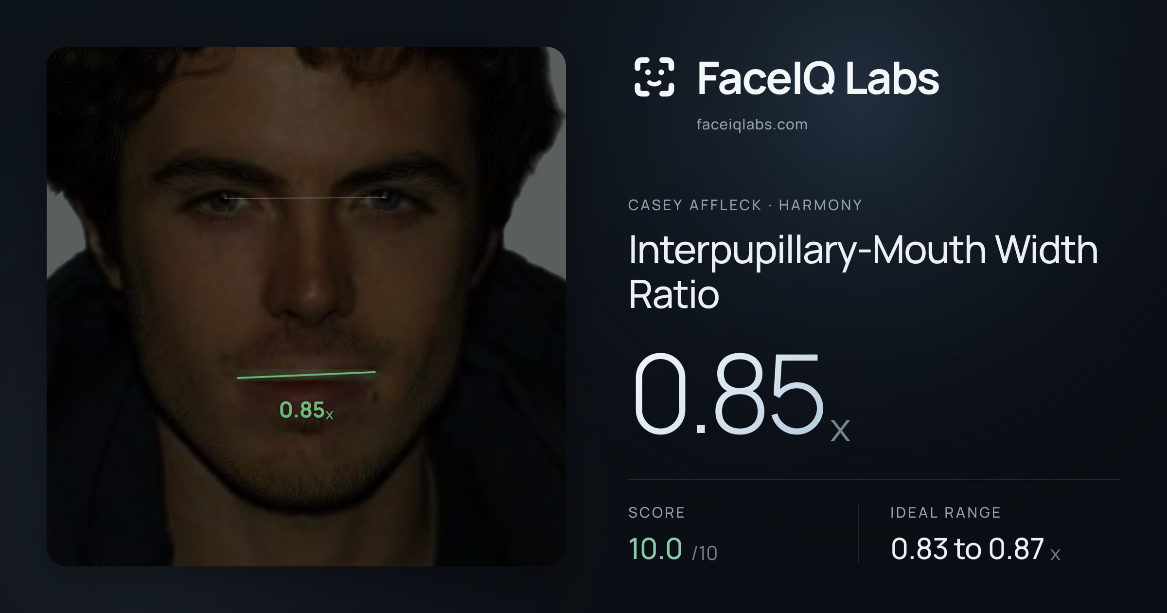 Casey Affleck Interpupillary-Mouth Width Ratio: 0.85x, drawn on the photo