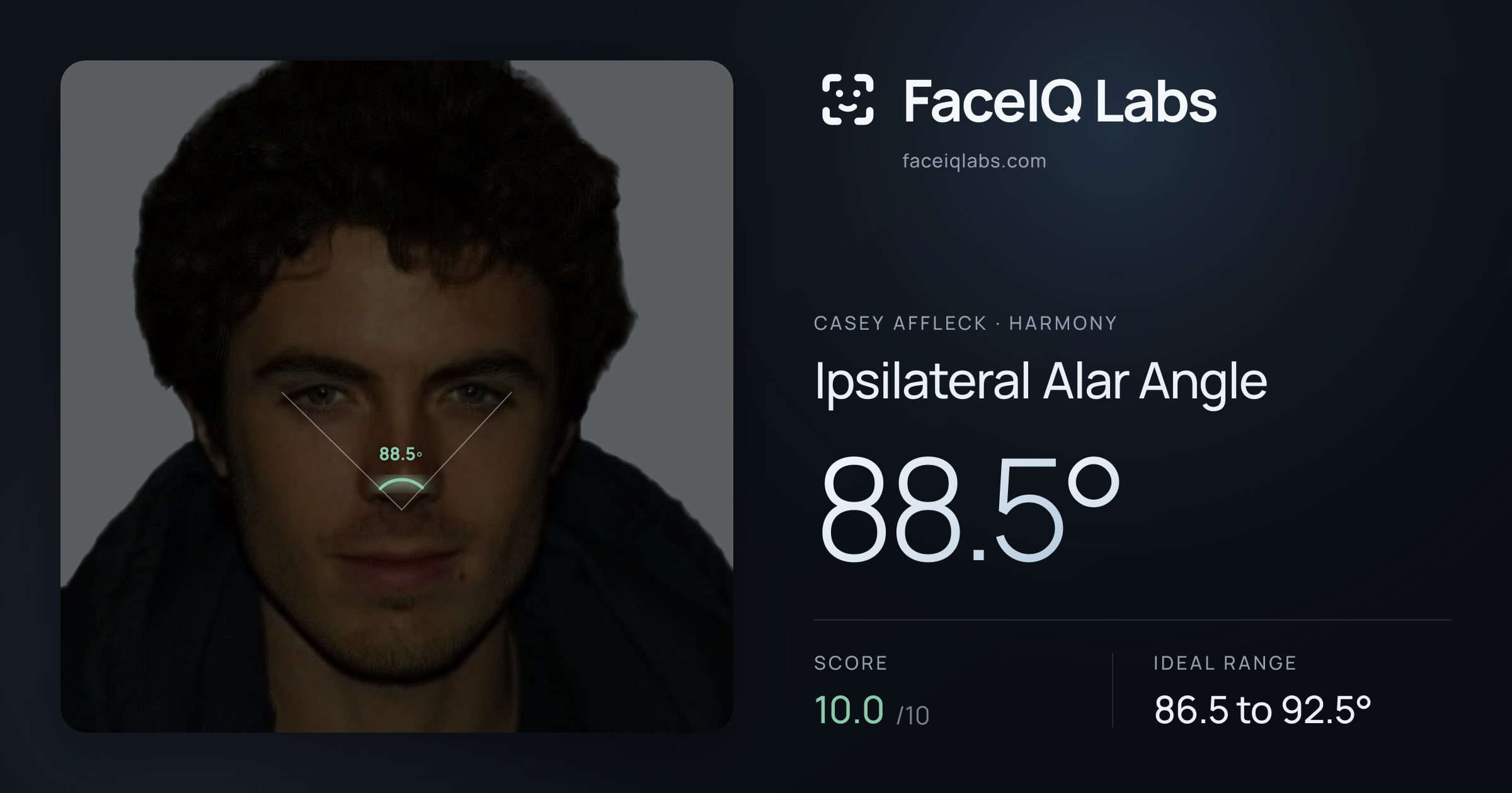 Casey Affleck Ipsilateral Alar Angle: 88.5°, drawn on the photo
