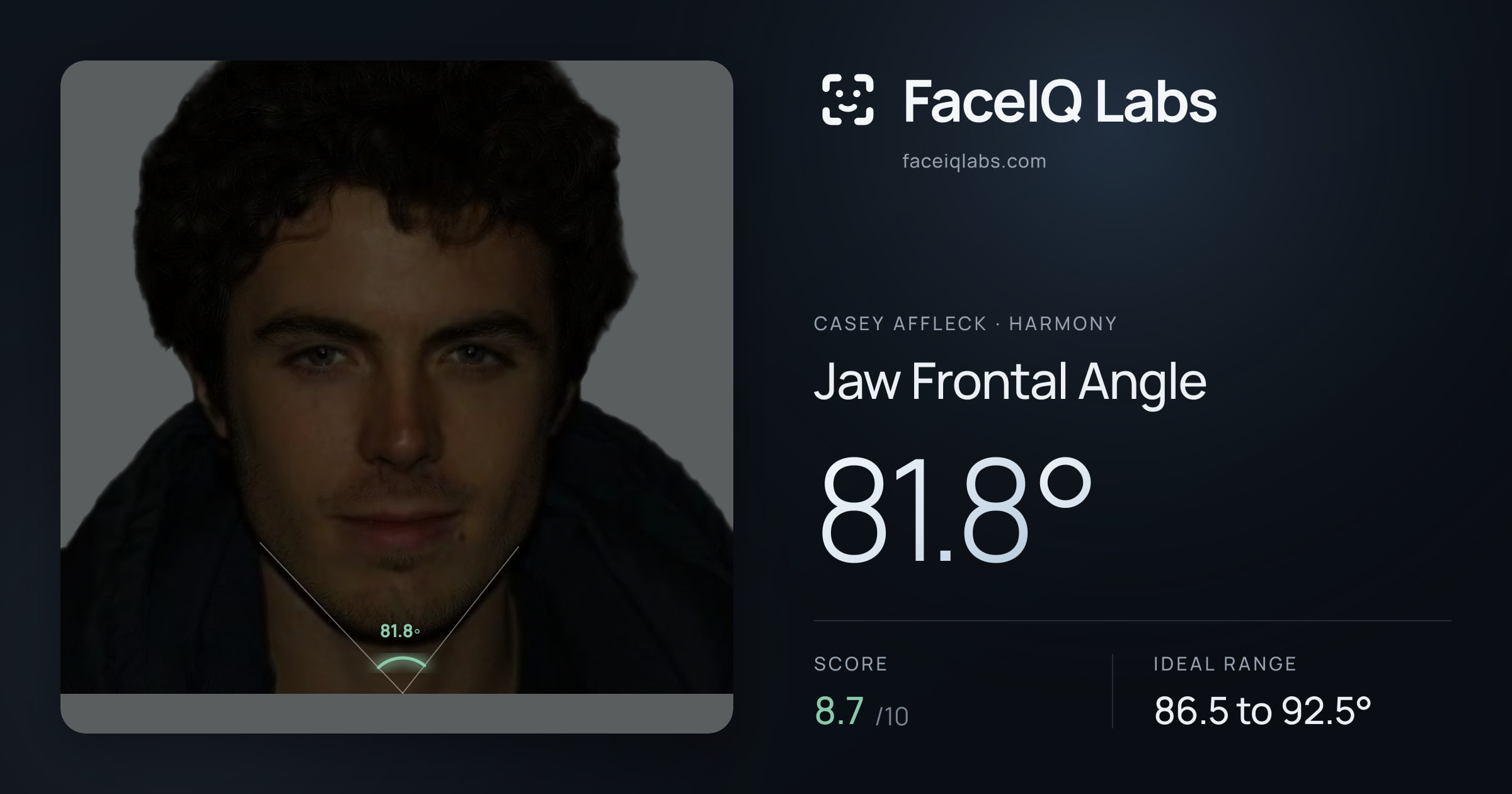 Casey Affleck Jaw Frontal Angle: 81.8°, drawn on the photo