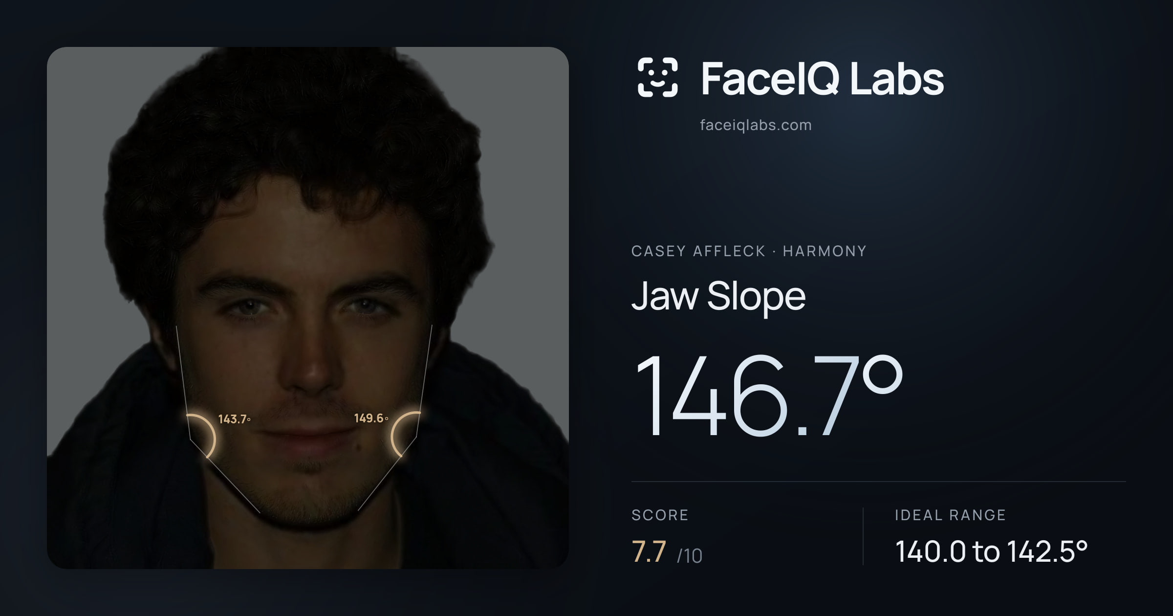 Casey Affleck Jaw Slope: 146.7°, drawn on the photo