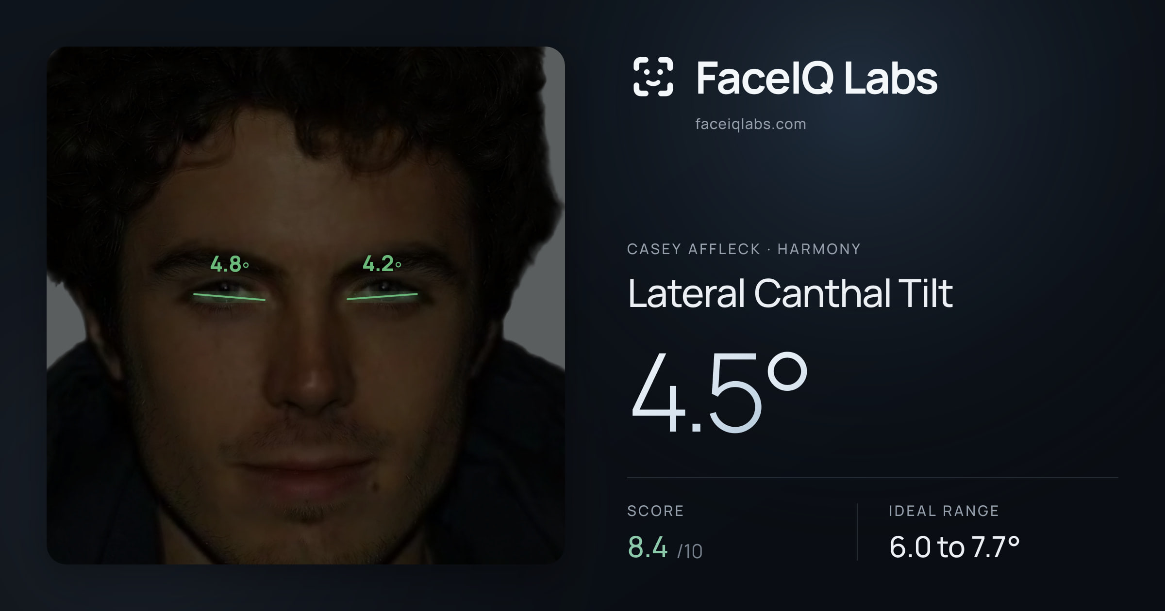 Casey Affleck Lateral Canthal Tilt: 4.5°, drawn on the photo