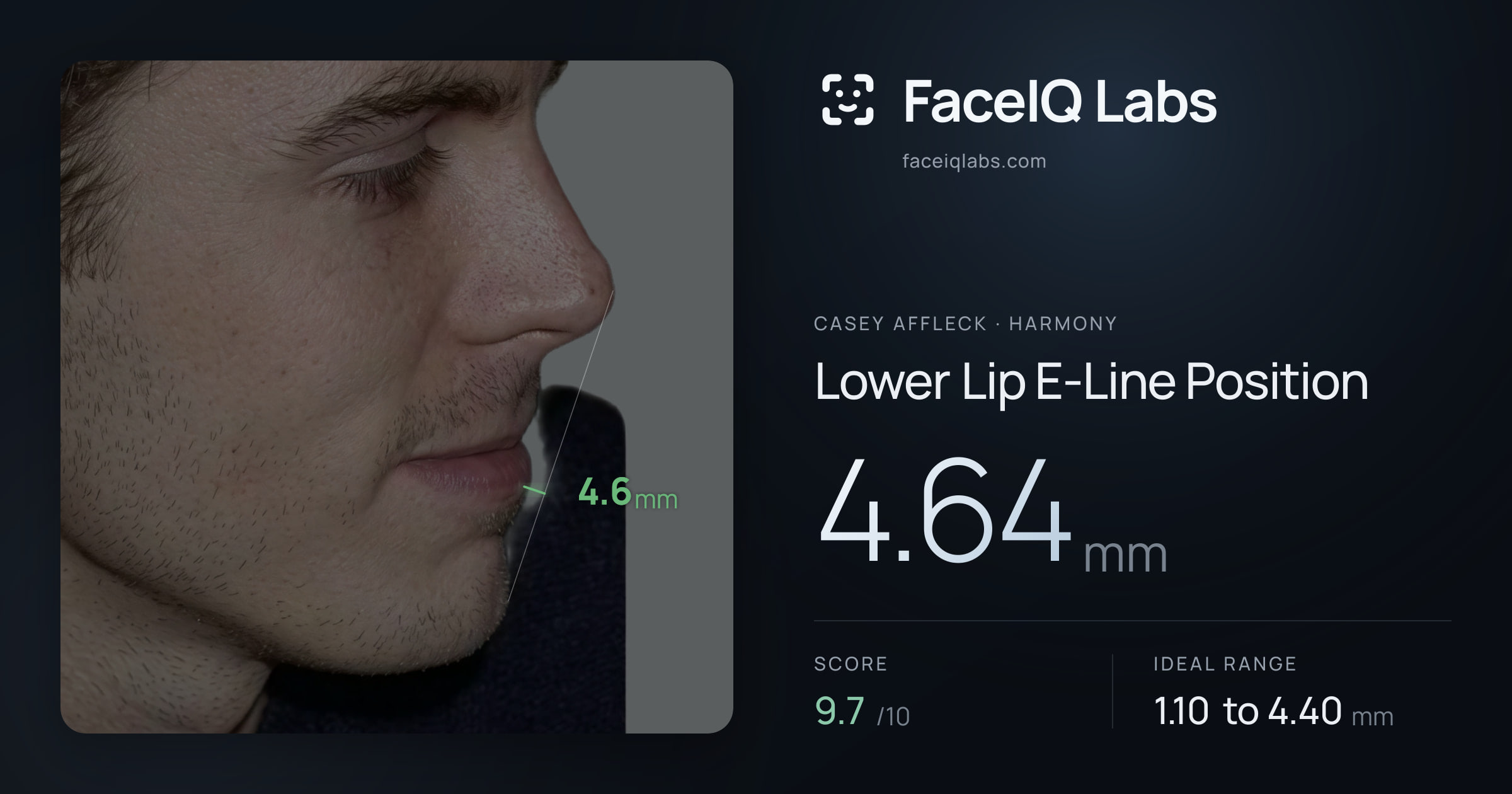 Casey Affleck Lower Lip E-Line Position: 4.64mm, drawn on the photo