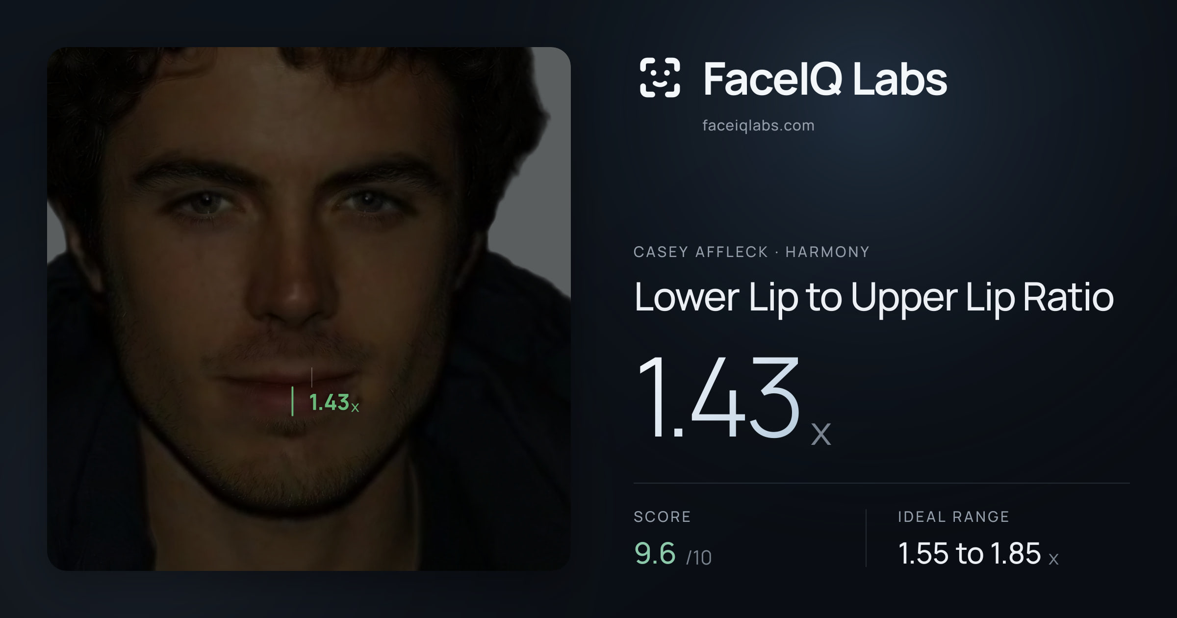 Casey Affleck Lower Lip to Upper Lip Ratio: 1.43x, drawn on the photo