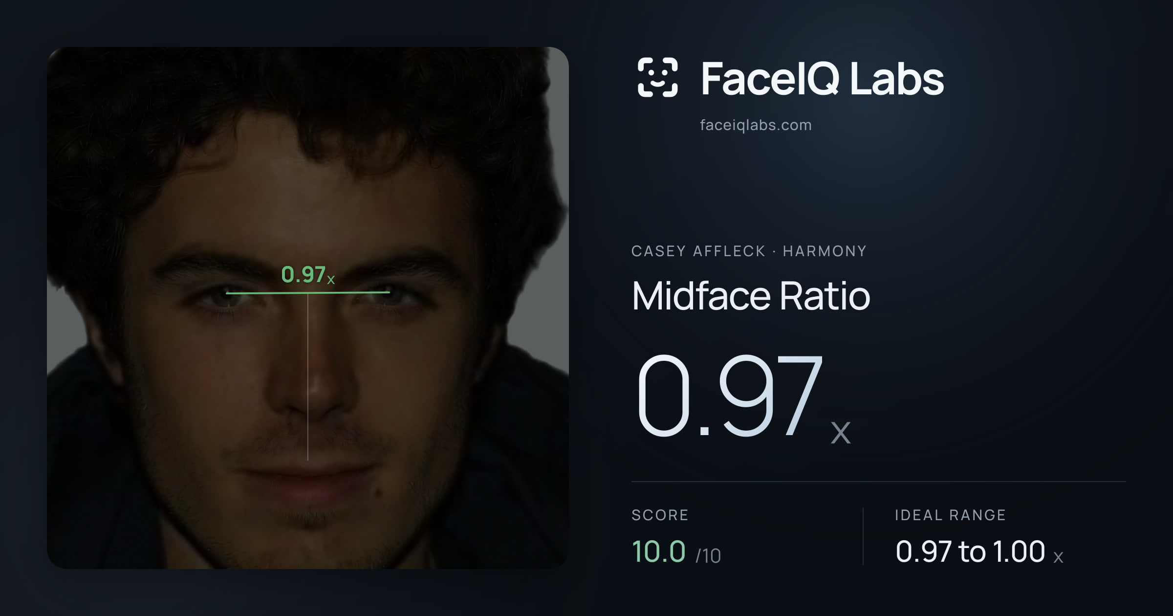 Casey Affleck Midface Ratio: 0.97x, drawn on the photo