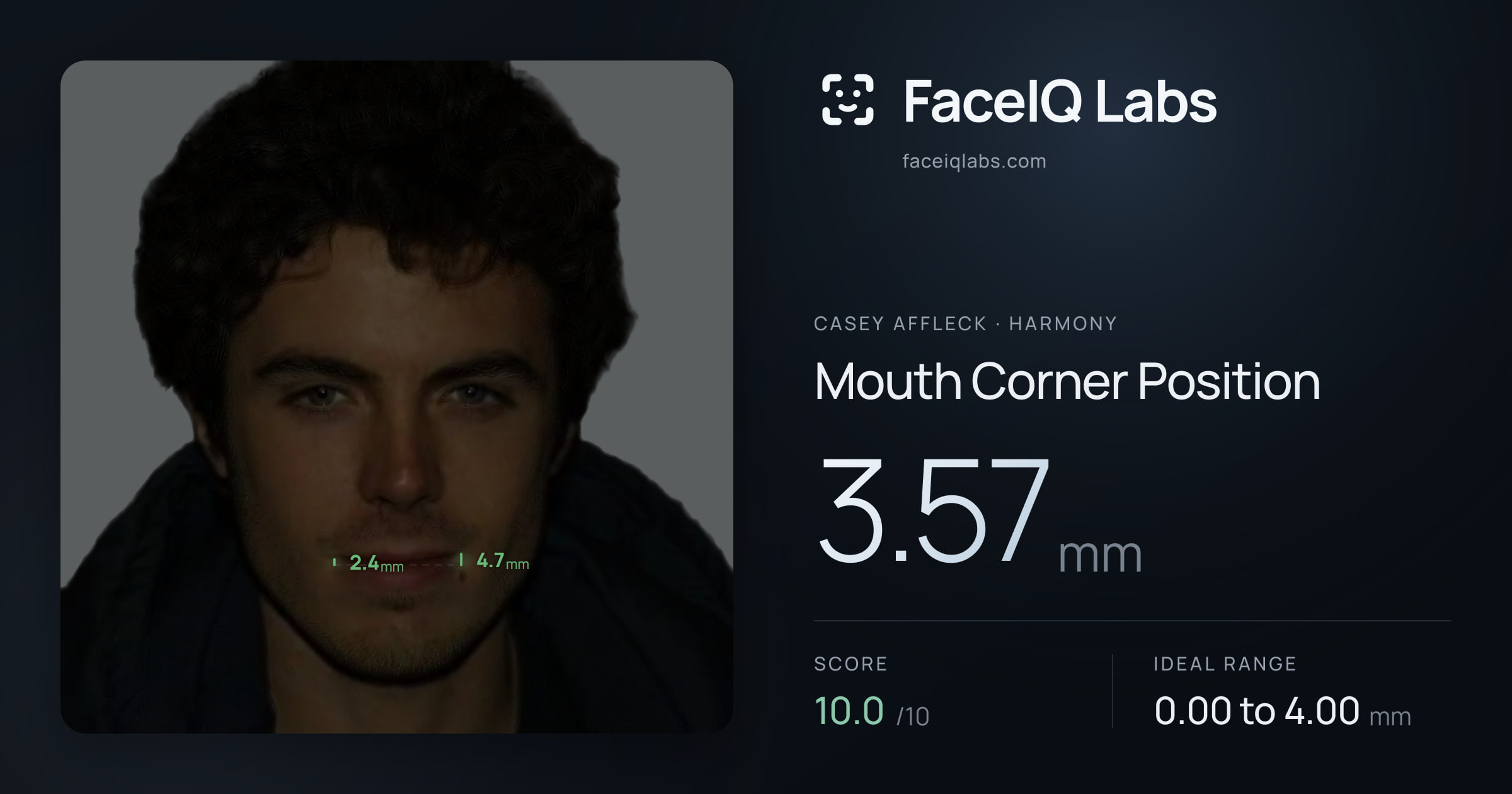 Casey Affleck Mouth Corner Position: 3.57mm, drawn on the photo