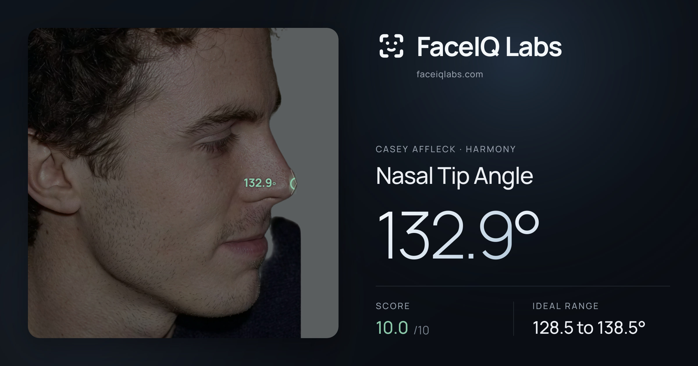 Casey Affleck Nasal Tip Angle: 132.9°, drawn on the photo