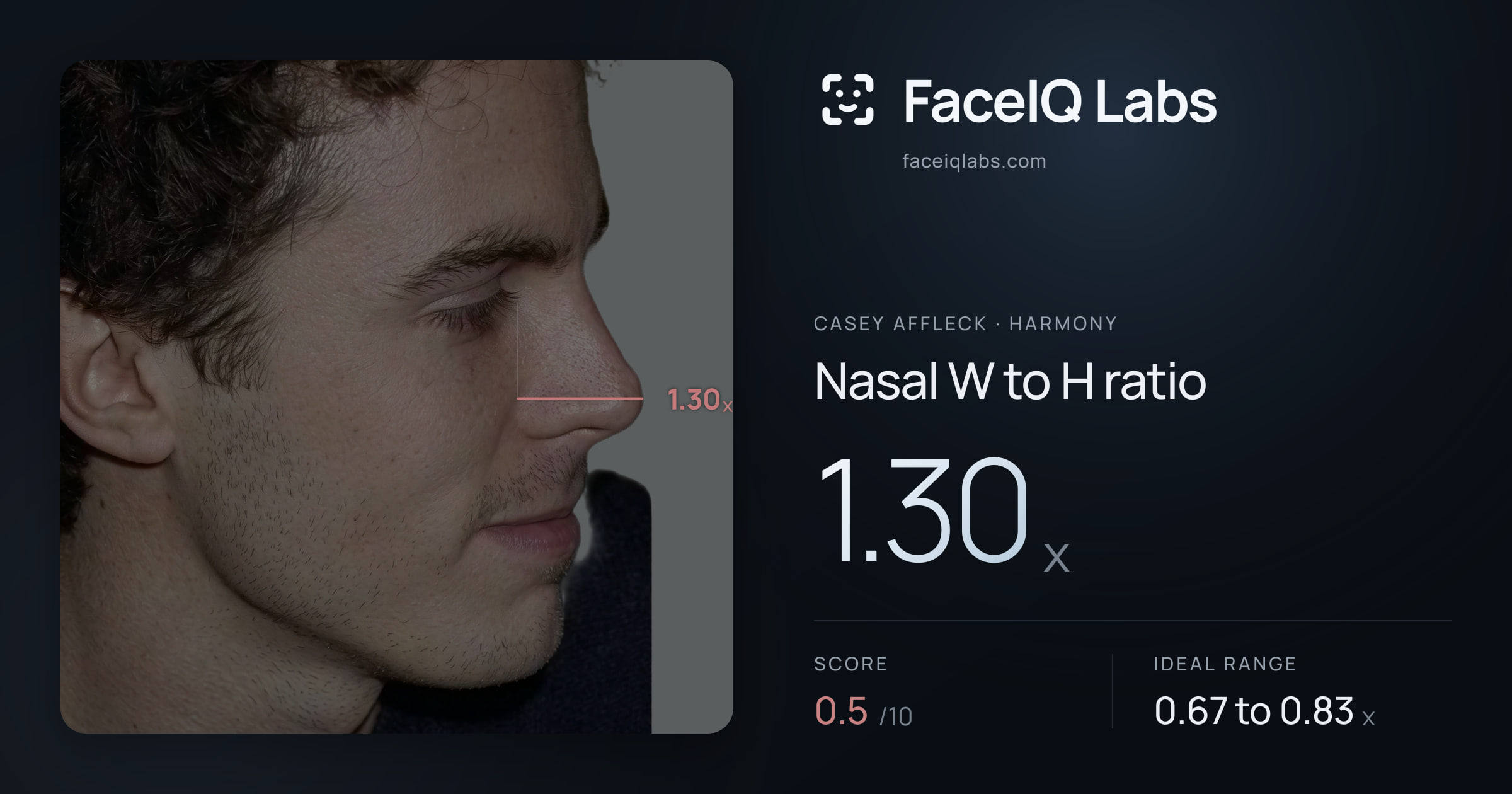 Casey Affleck Nasal W to H ratio: 1.30x, drawn on the photo