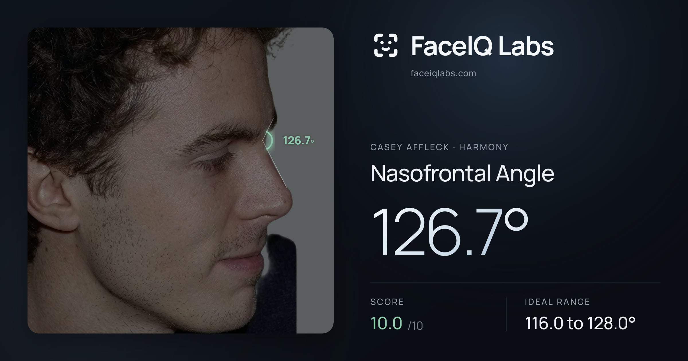 Casey Affleck Nasofrontal Angle: 126.7°, drawn on the photo