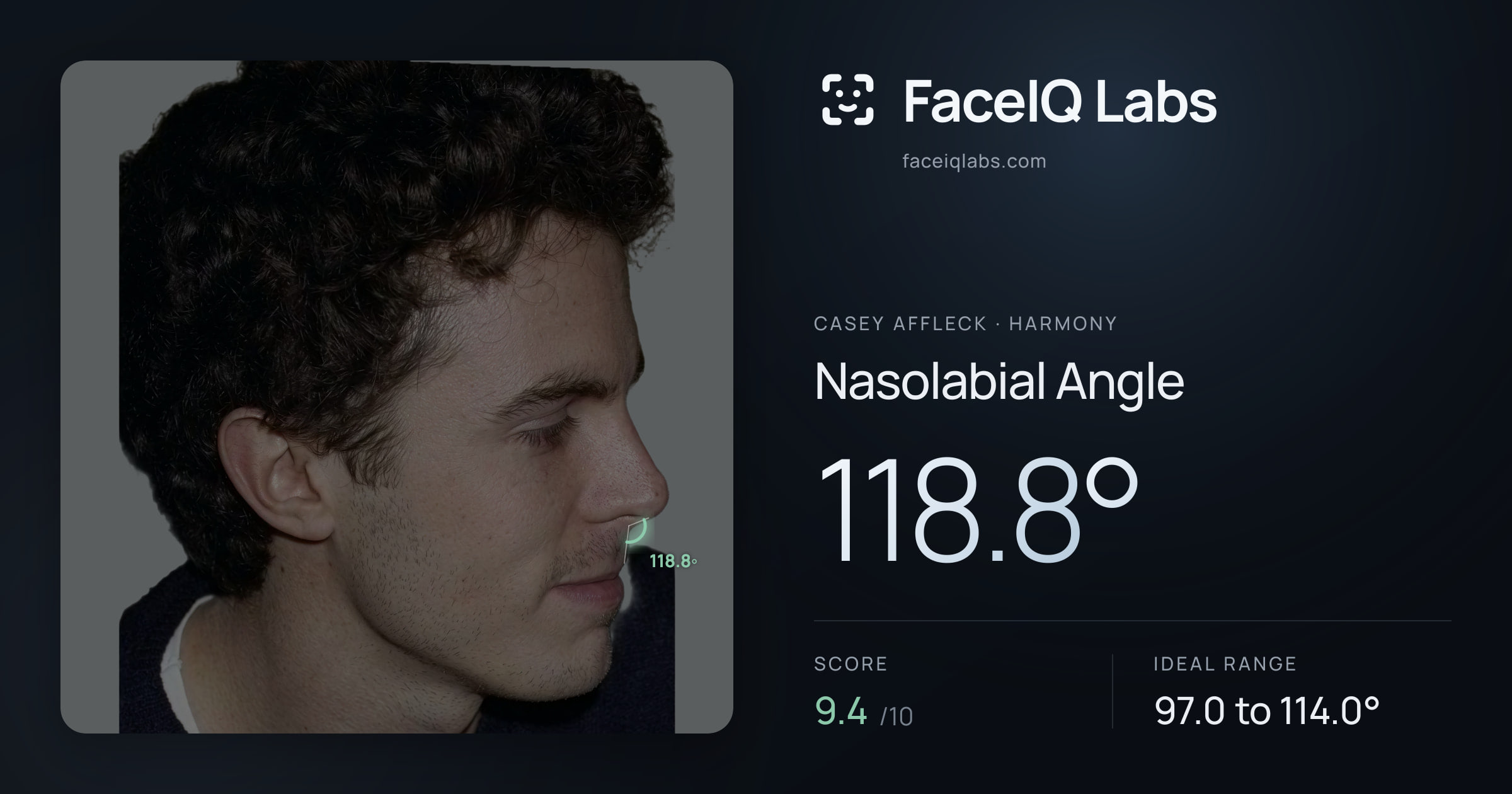 Casey Affleck Nasolabial Angle: 118.8°, drawn on the photo