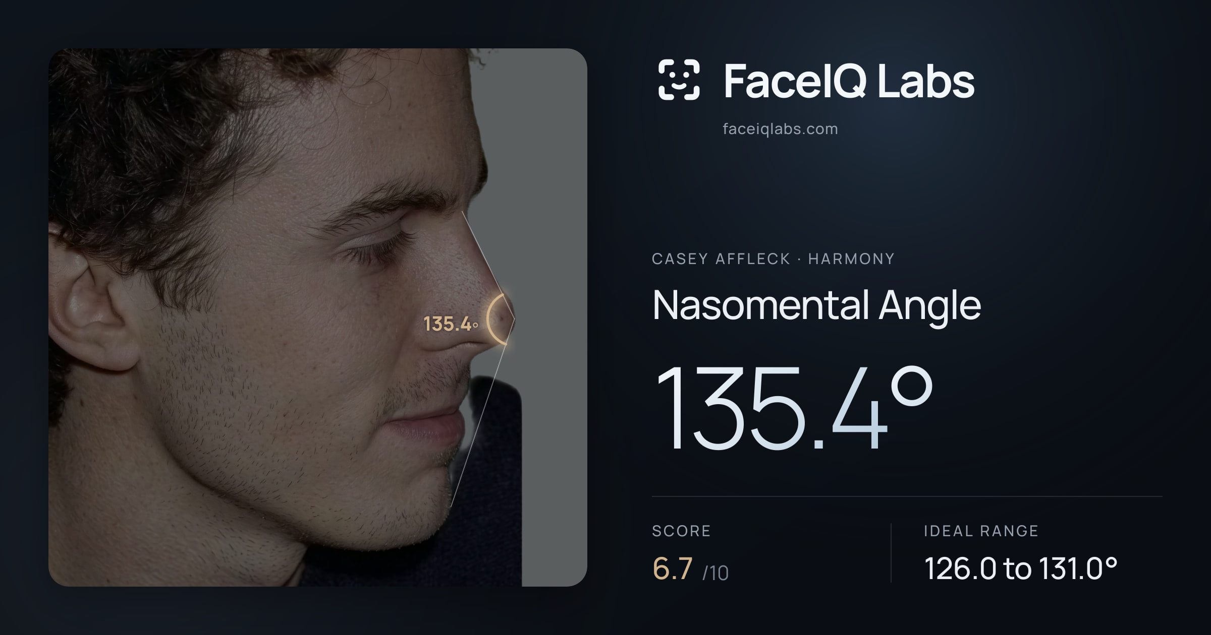 Casey Affleck Nasomental Angle: 135.4°, drawn on the photo