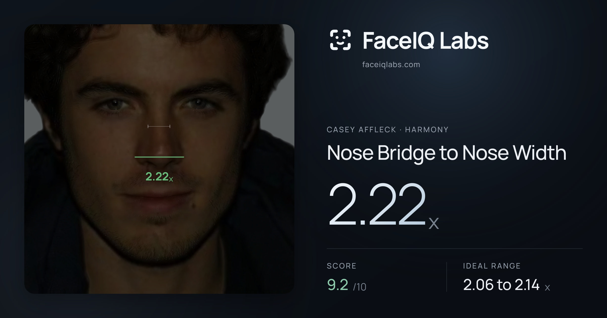Casey Affleck Nose Bridge to Nose Width: 2.22x, drawn on the photo
