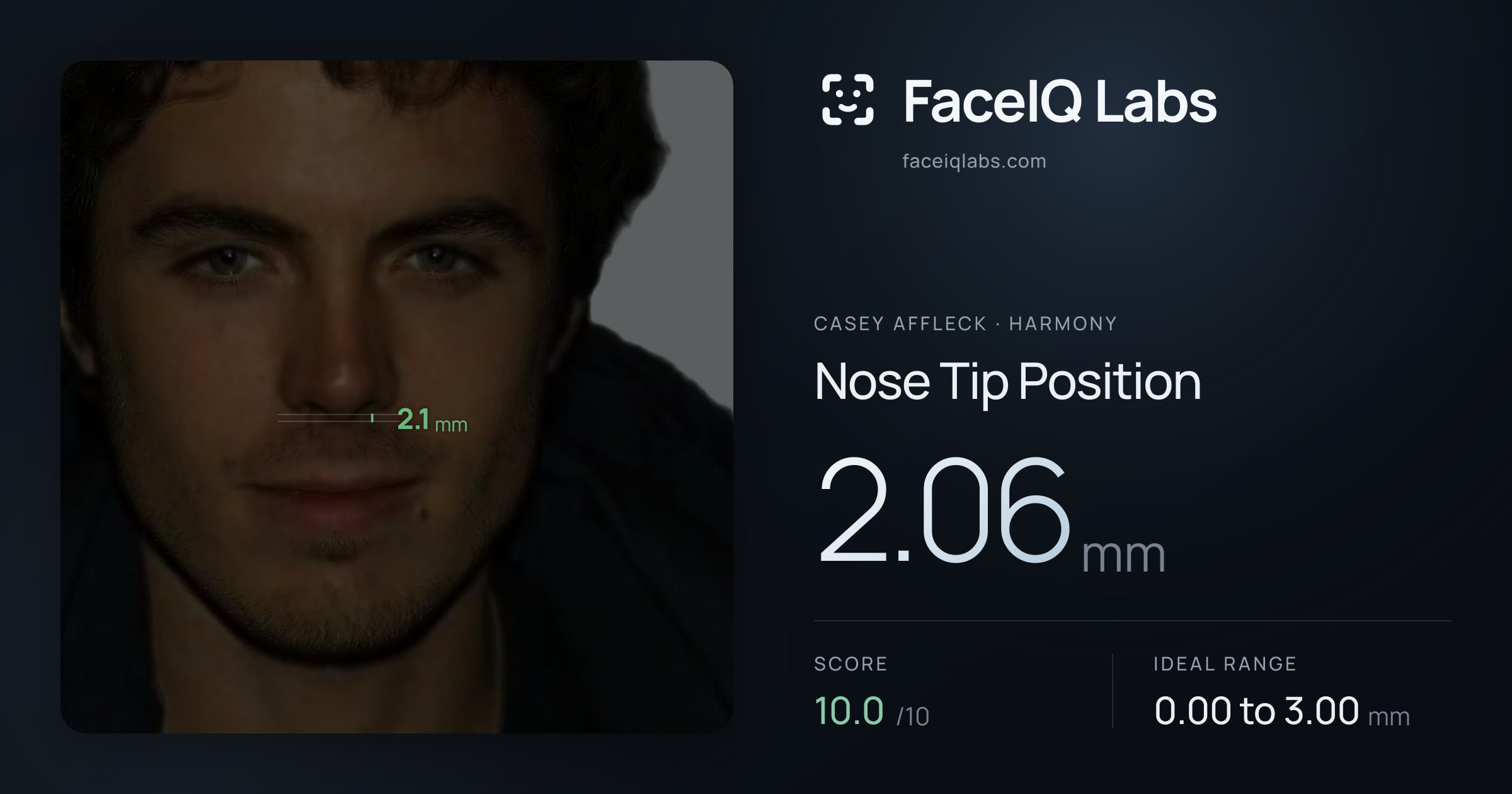 Casey Affleck Nose Tip Position: 2.06mm, drawn on the photo