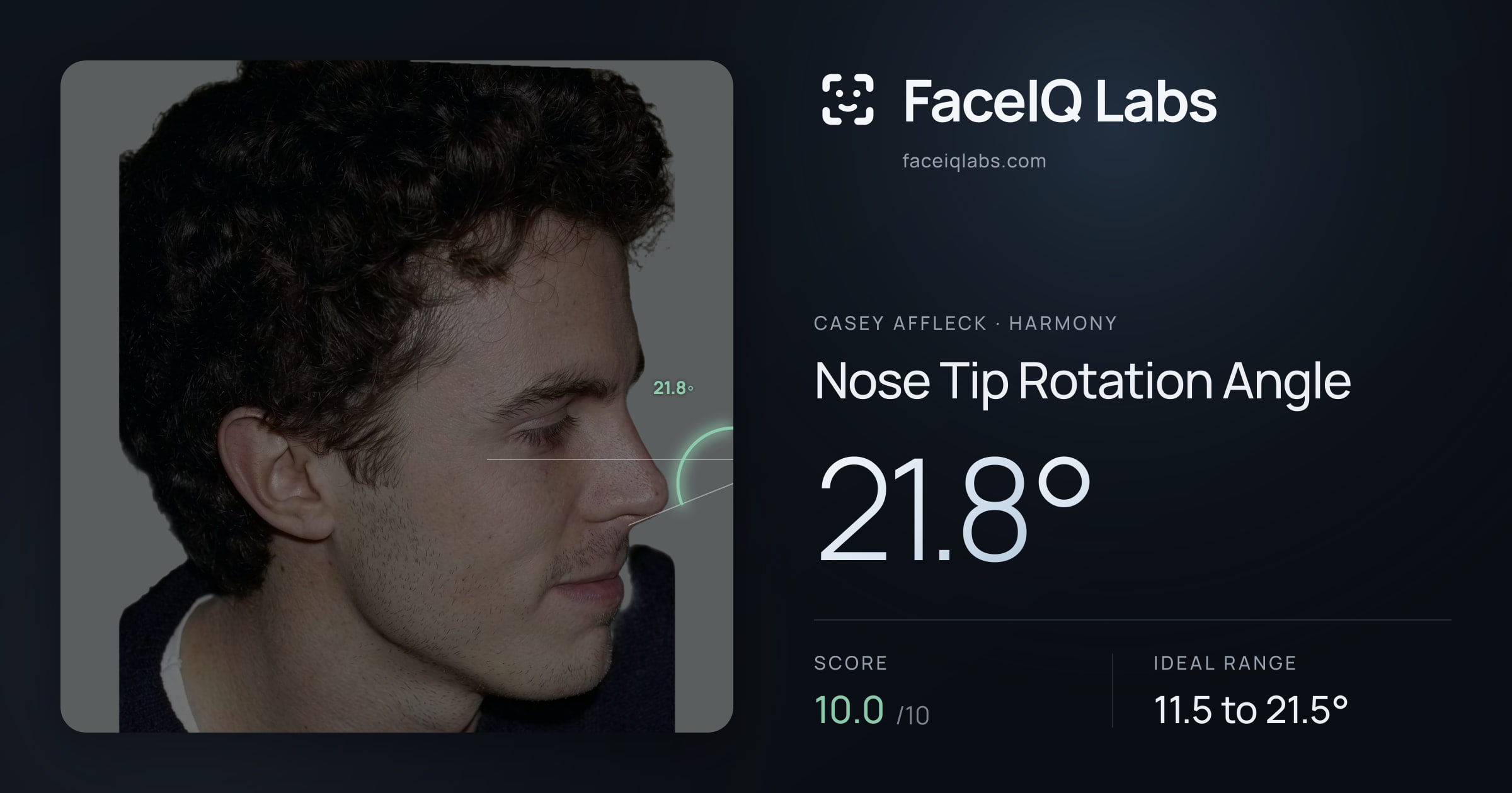 Casey Affleck Nose Tip Rotation Angle: 21.8°, drawn on the photo
