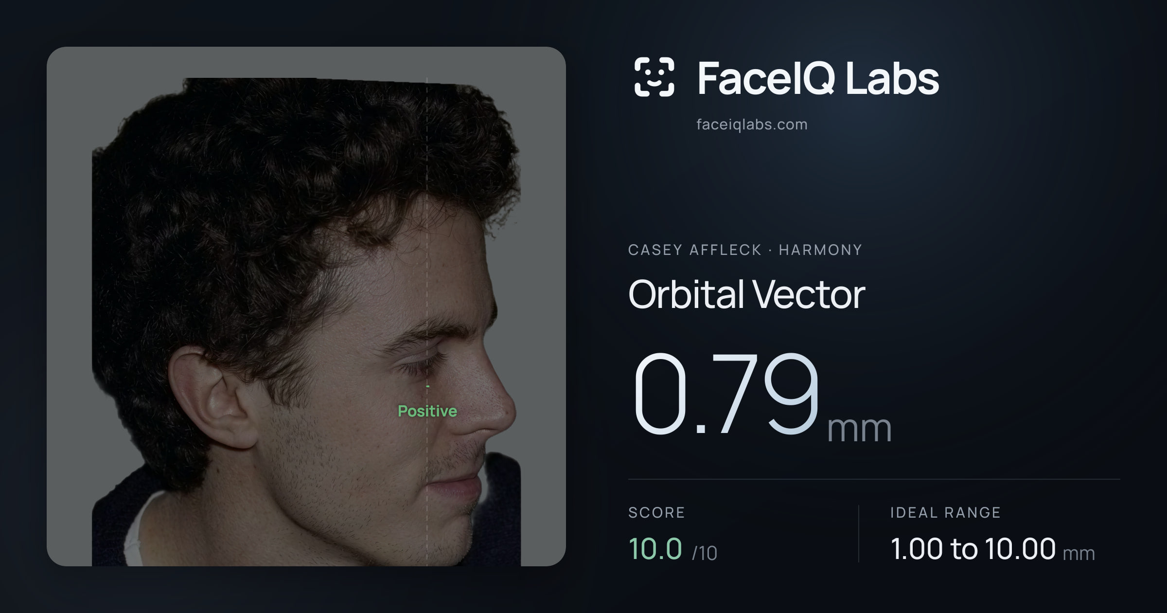 Casey Affleck Orbital Vector: 0.79mm, drawn on the photo