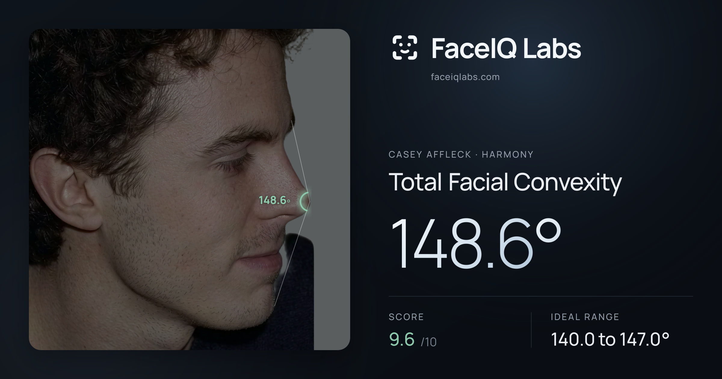 Casey Affleck Total Facial Convexity: 148.6°, drawn on the photo