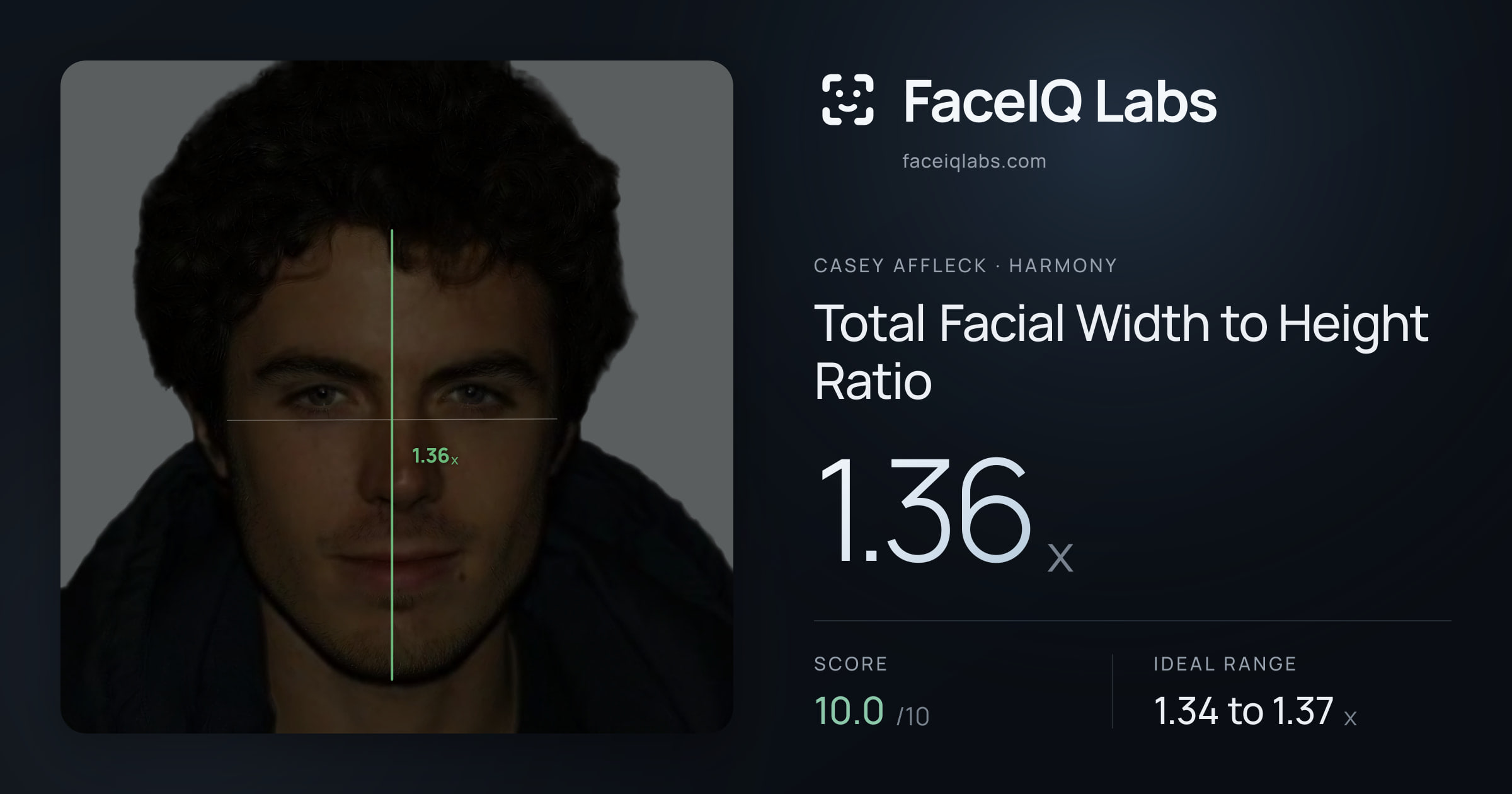 Casey Affleck Total Facial Width to Height Ratio: 1.36x, drawn on the photo