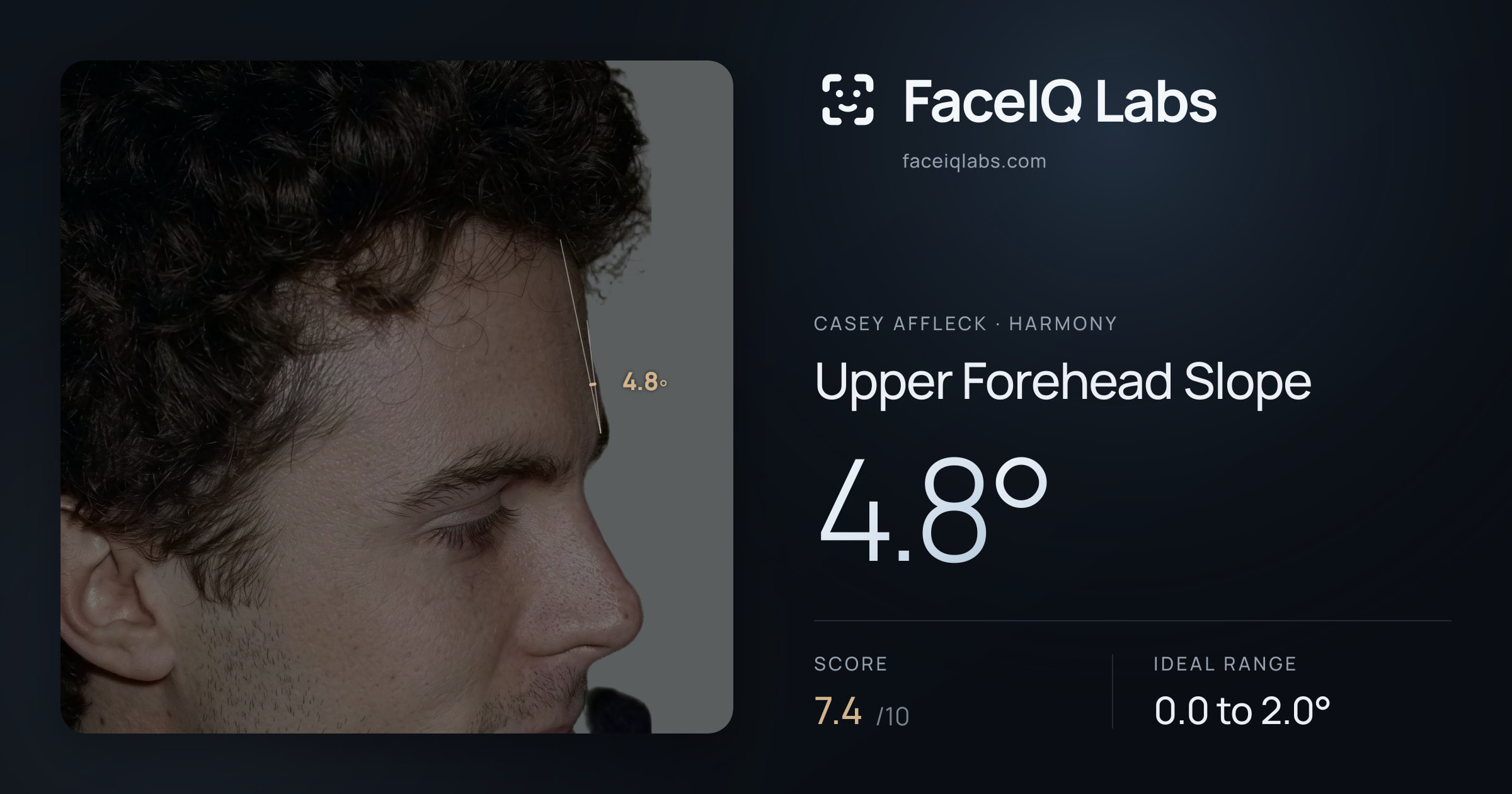 Casey Affleck Upper Forehead Slope: 4.8°, drawn on the photo