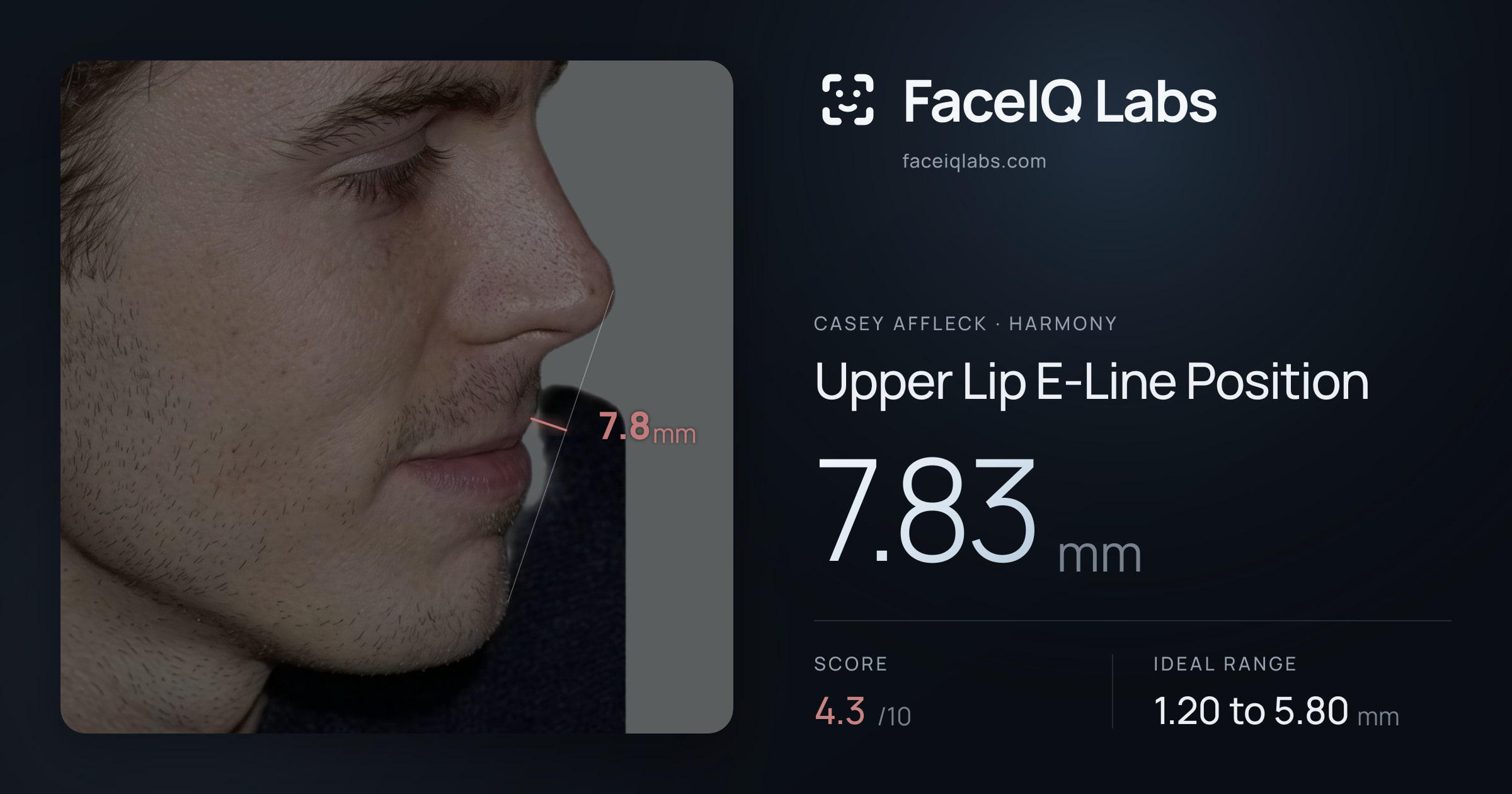 Casey Affleck Upper Lip E-Line Position: 7.83mm, drawn on the photo