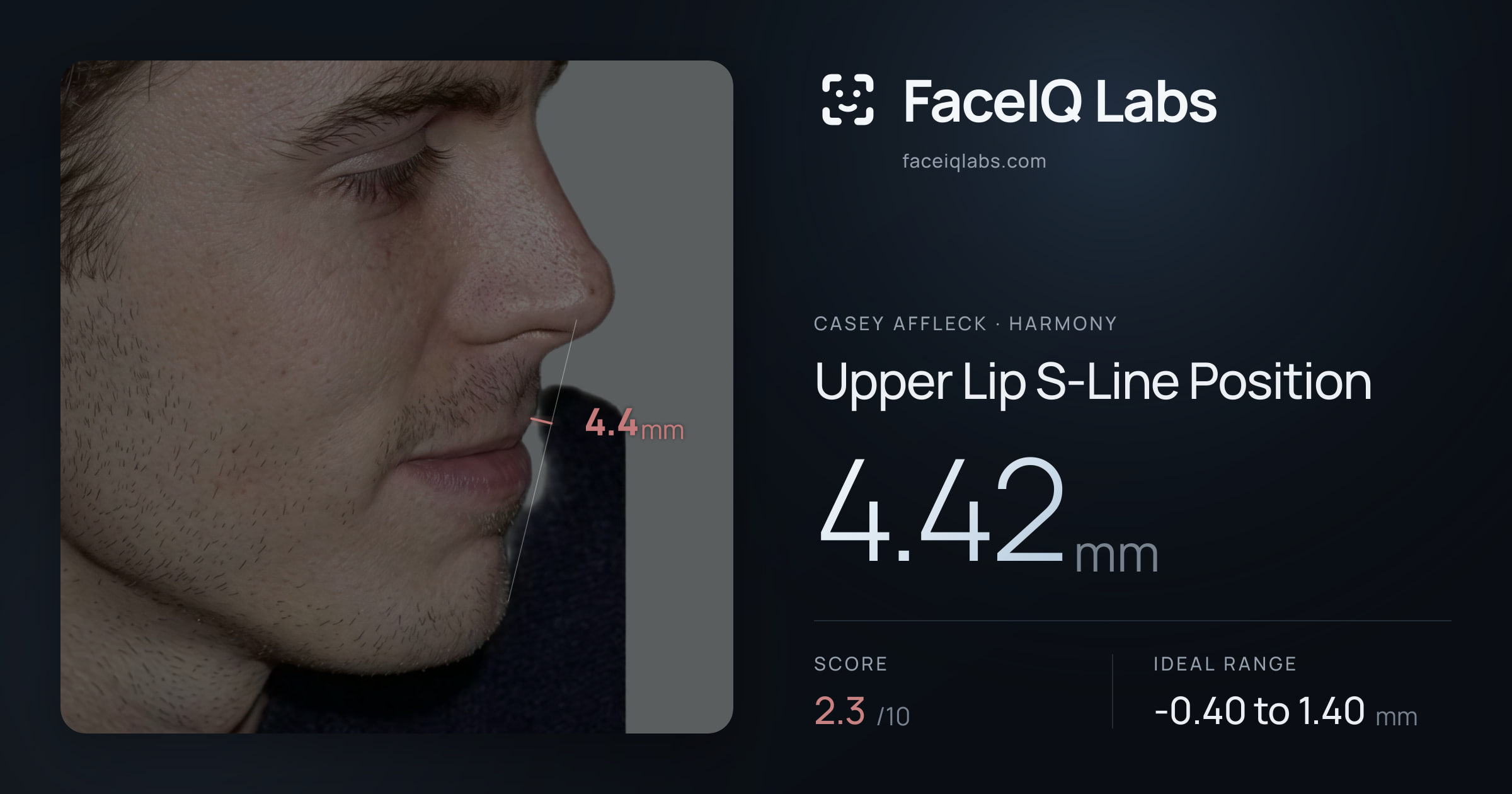 Casey Affleck Upper Lip S-Line Position: 4.42mm, drawn on the photo